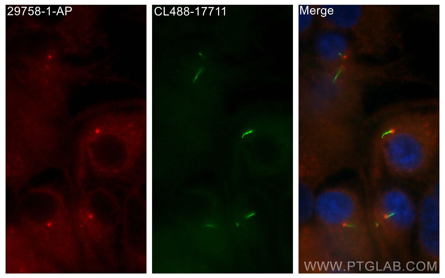 IF Staining of hTERT-RPE1 using 29758-1-AP (same clone as 29758-1-PBS)