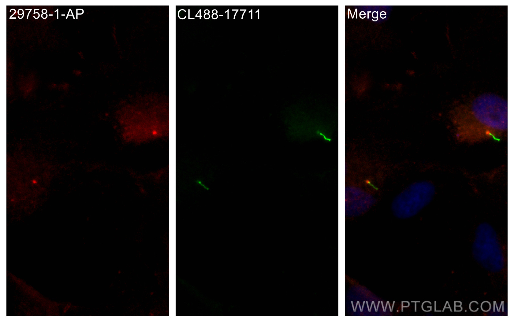 IF Staining of hTERT-RPE1 using 29758-1-AP (same clone as 29758-1-PBS)