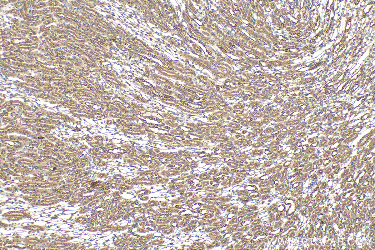 IHC staining of mouse kidney using 29758-1-AP (same clone as 29758-1-PBS)