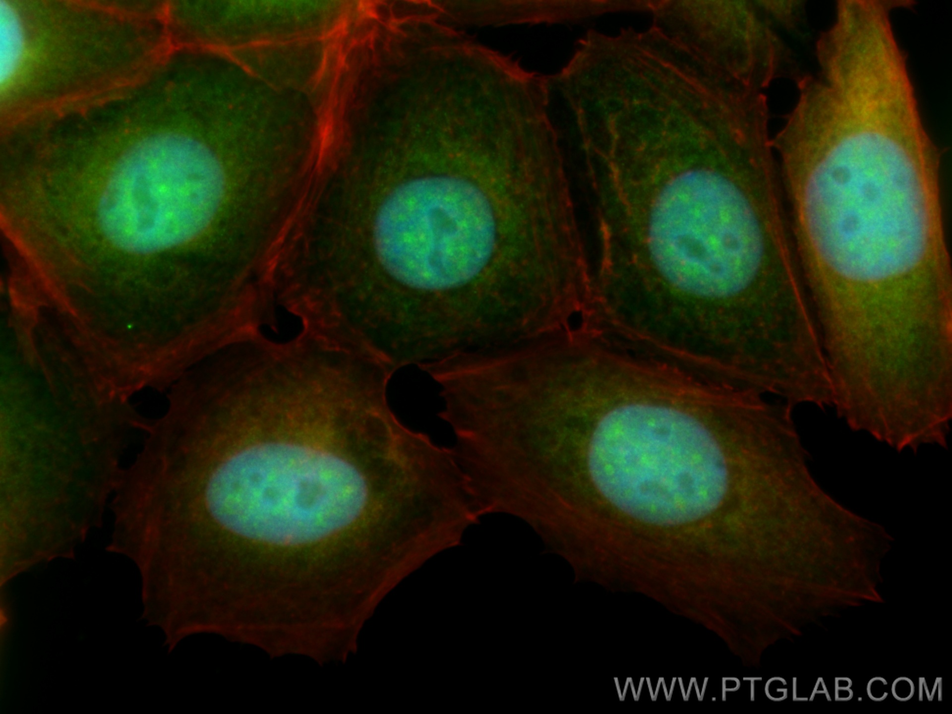 IF Staining of MCF-7 using 18130-1-AP