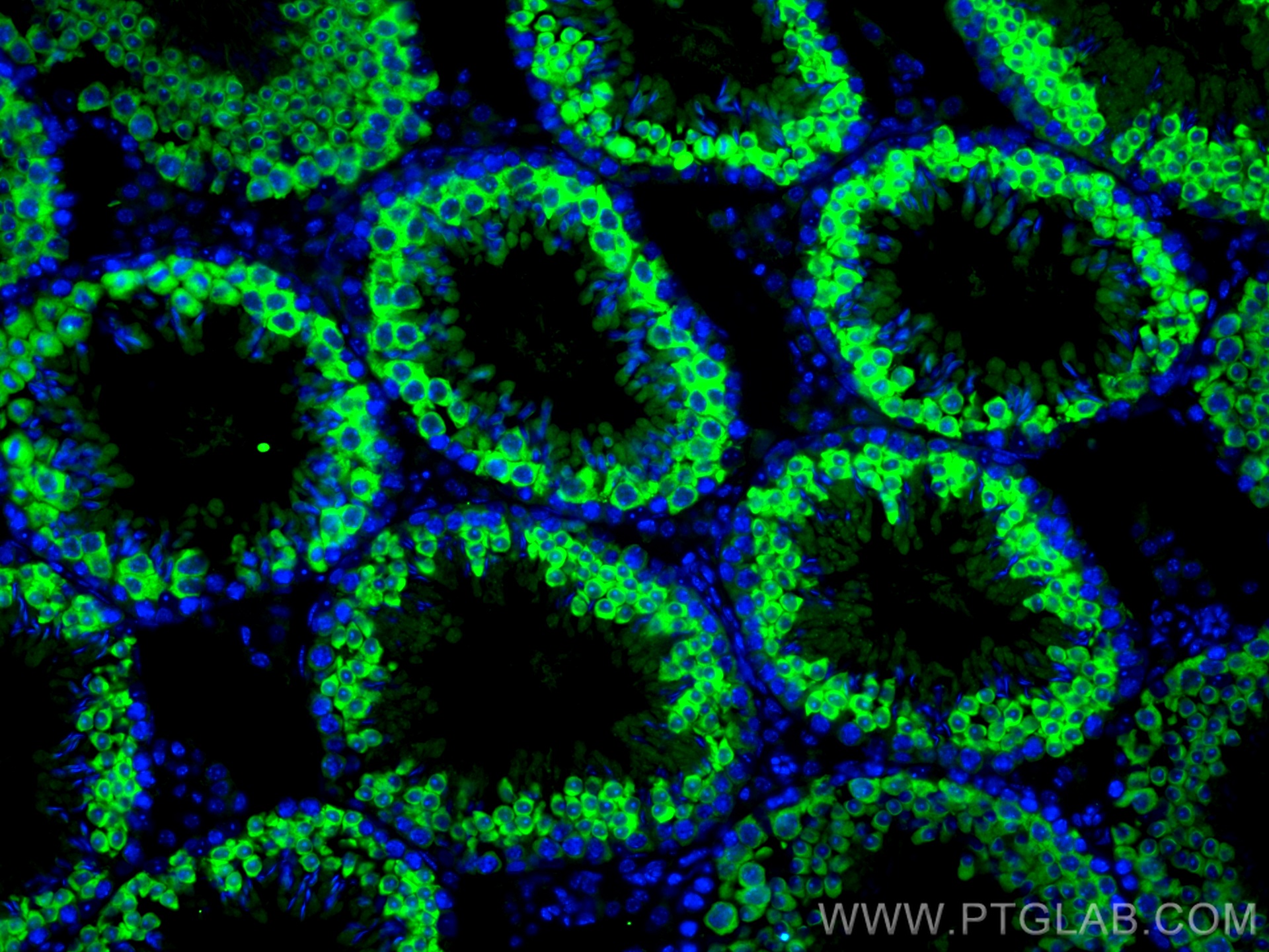 IF Staining of mouse testis using 11954-1-AP