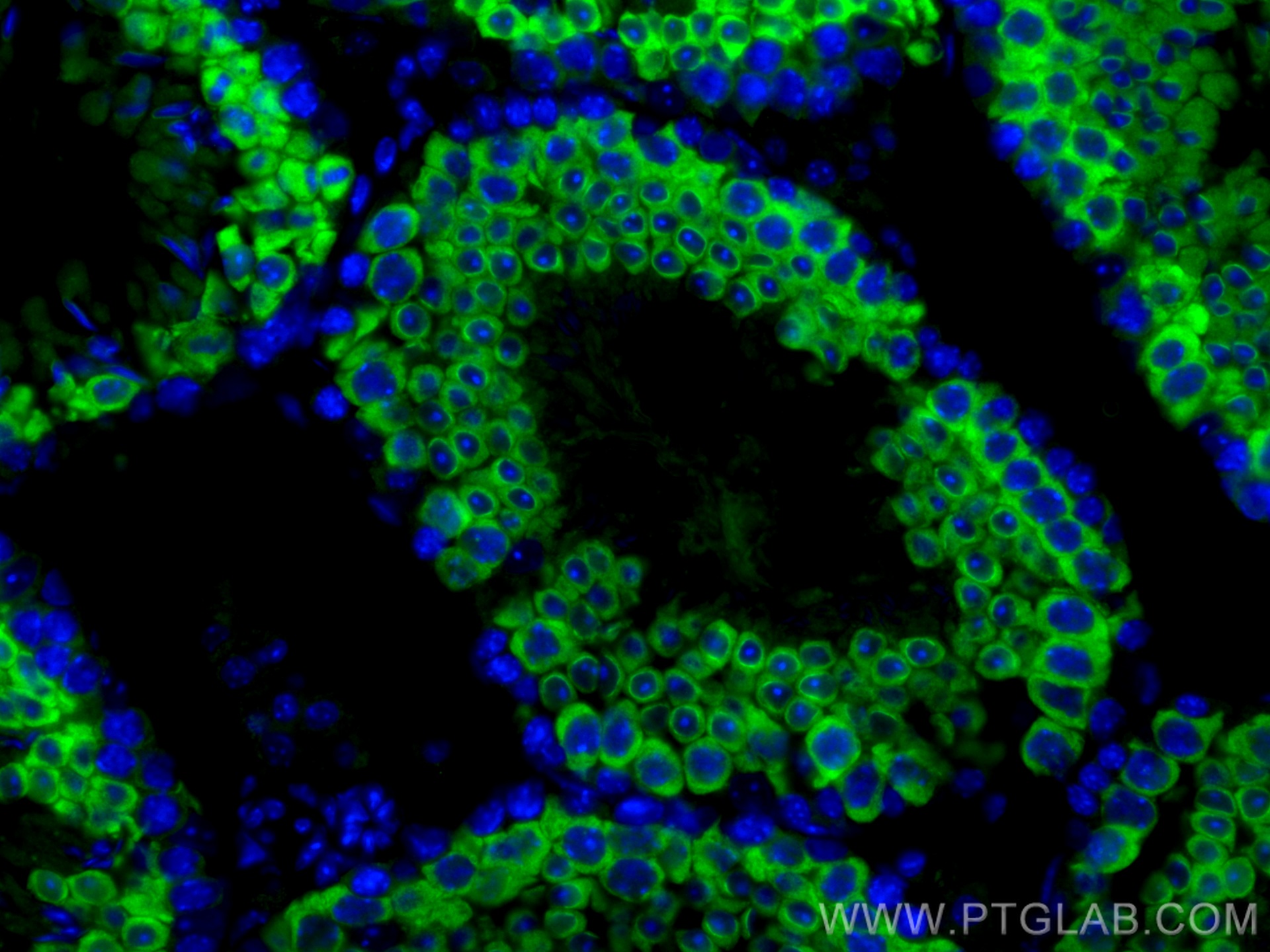 IF Staining of mouse testis using 11954-1-AP