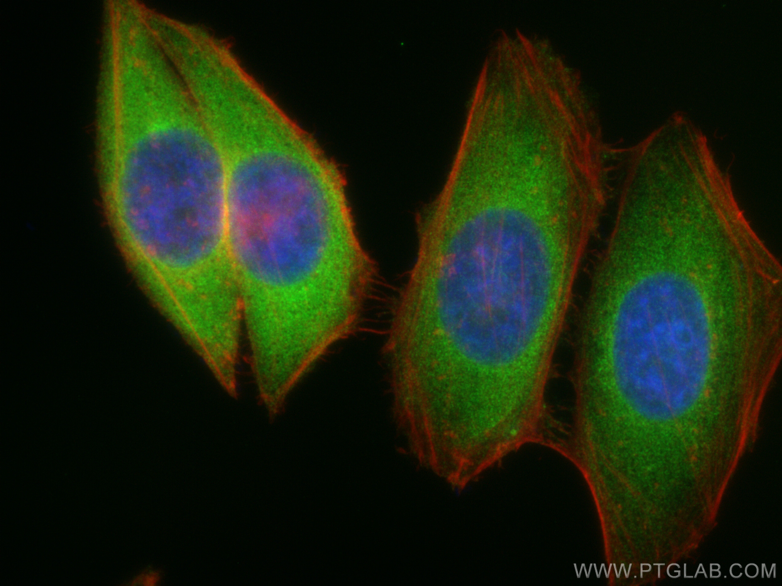 IF Staining of HepG2 using 11687-1-AP