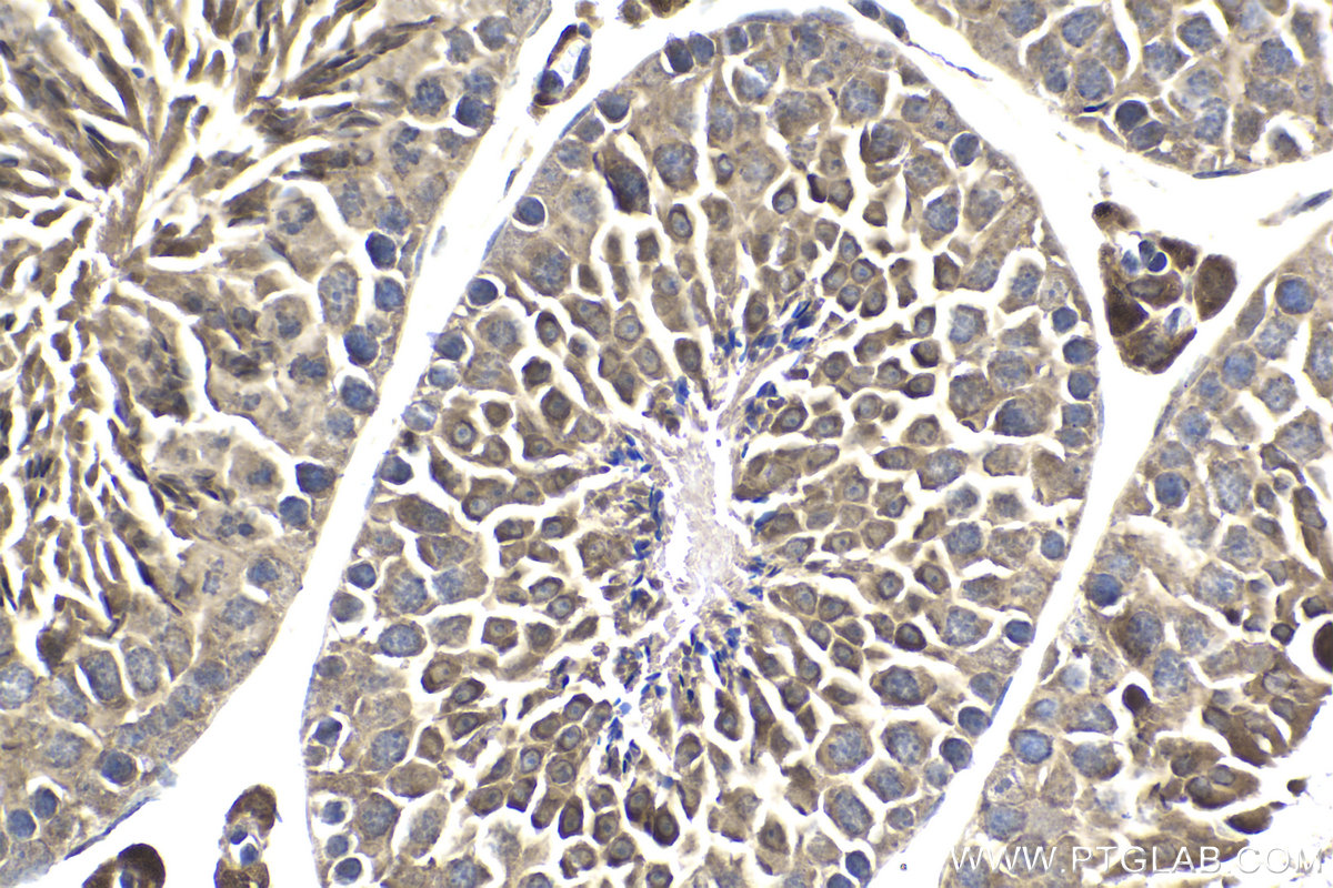 IHC staining of mouse testis using 13779-1-AP