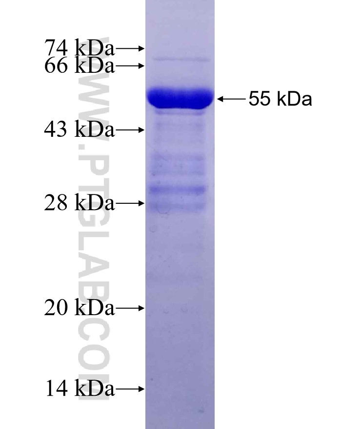 Dendrin fusion protein Ag29508 SDS-PAGE