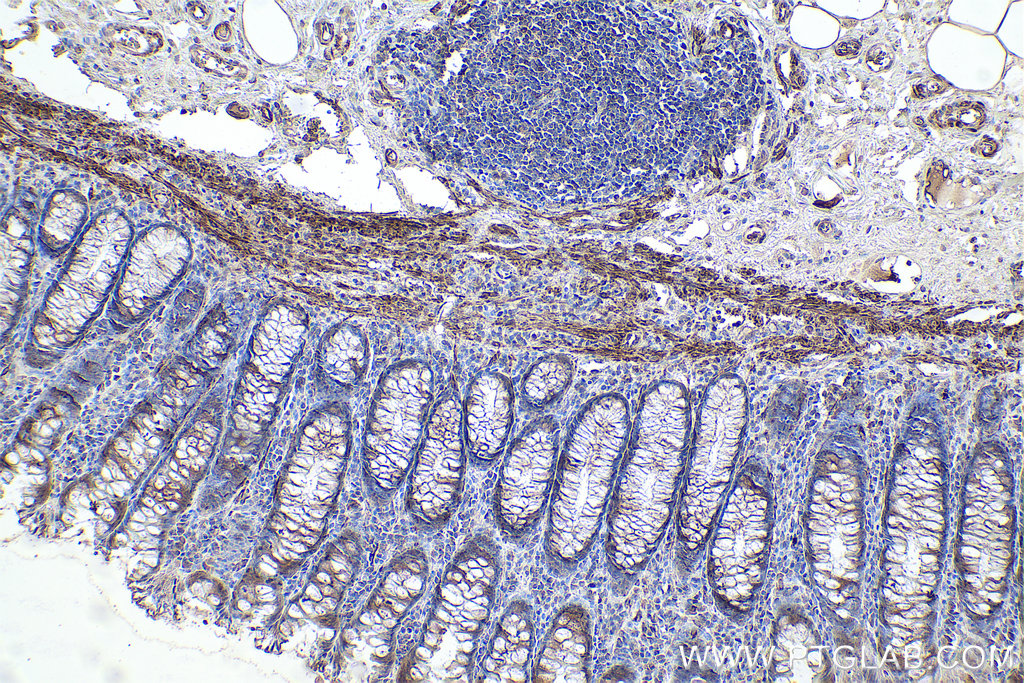 IHC staining of human colon using 67793-1-Ig