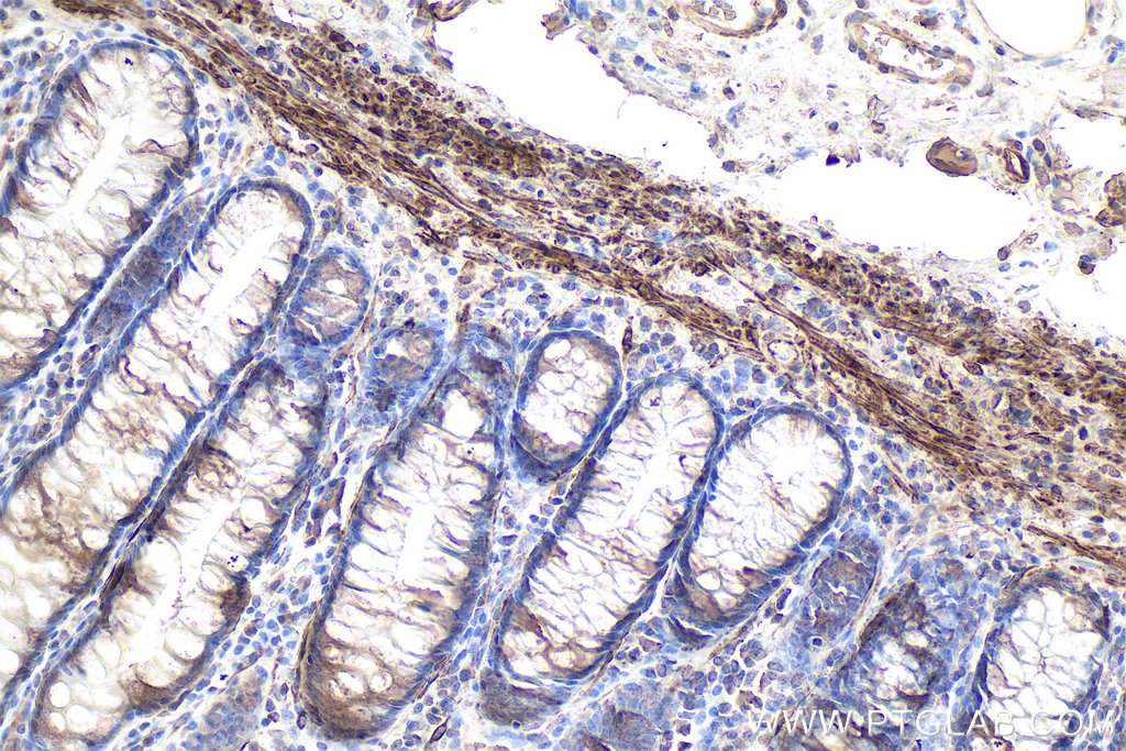 IHC staining of human colon using 67793-1-Ig