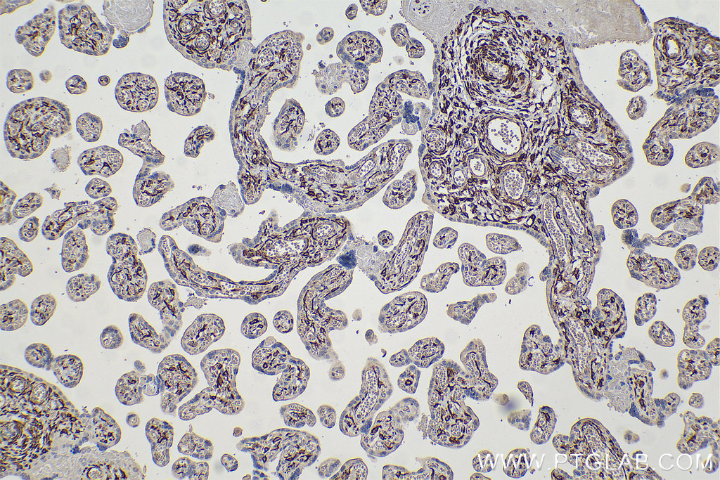 IHC staining of human placenta using 67793-1-Ig