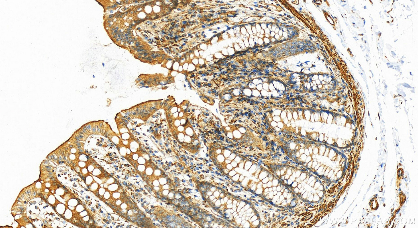 IHC staining of human normal colon using 82748-1-RR