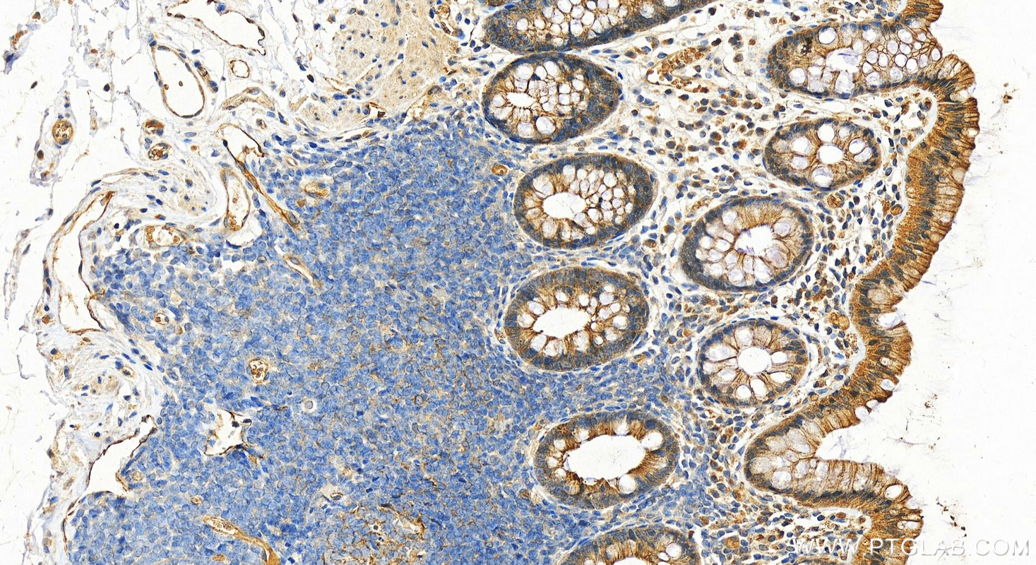 IHC staining of human normal colon using 25318-1-AP