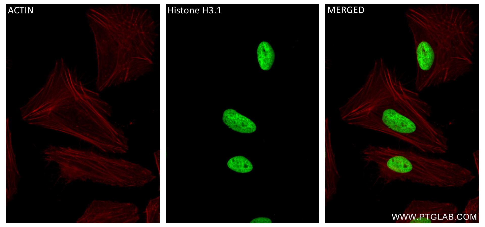 IF Staining of HeLa using 84702-1-RR (same clone as 84702-1-PBS)