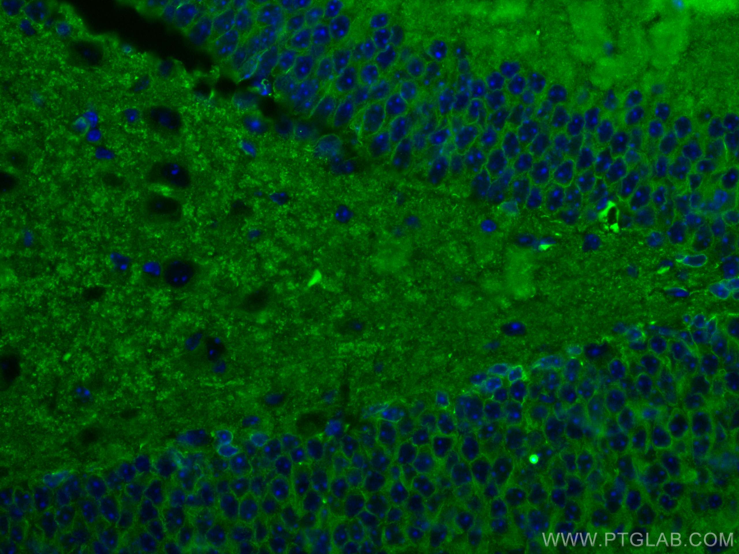 IF Staining of mouse brain using 67589-1-Ig (same clone as 67589-1-PBS)