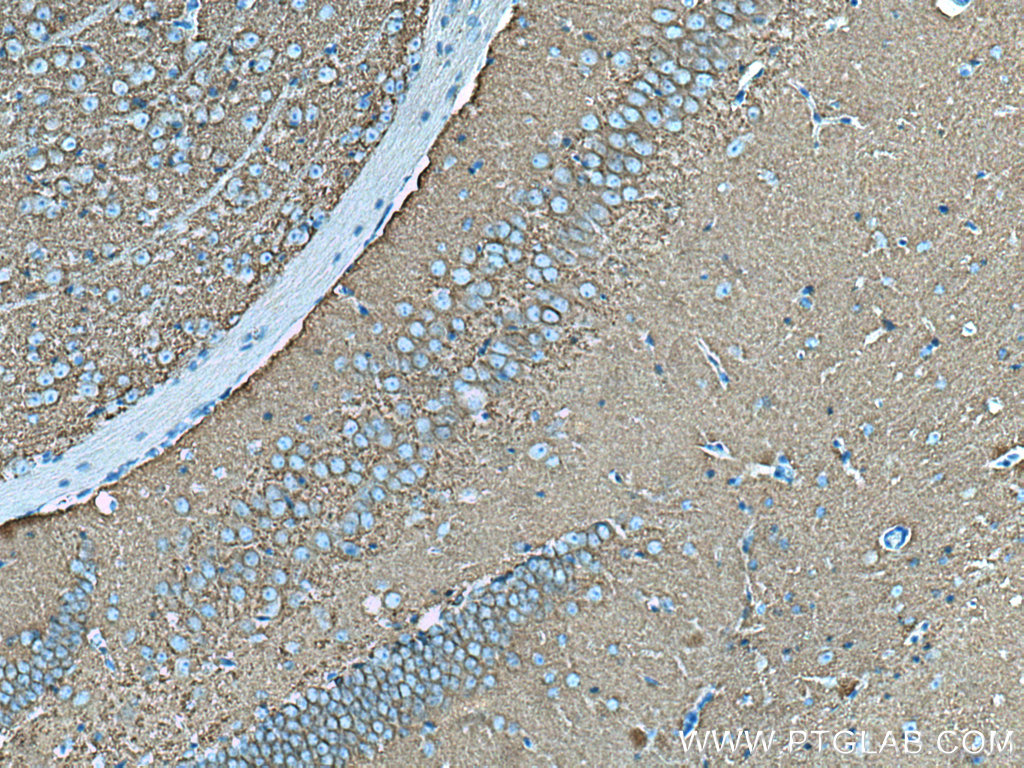 IHC staining of mouse brain using 67589-1-Ig (same clone as 67589-1-PBS)