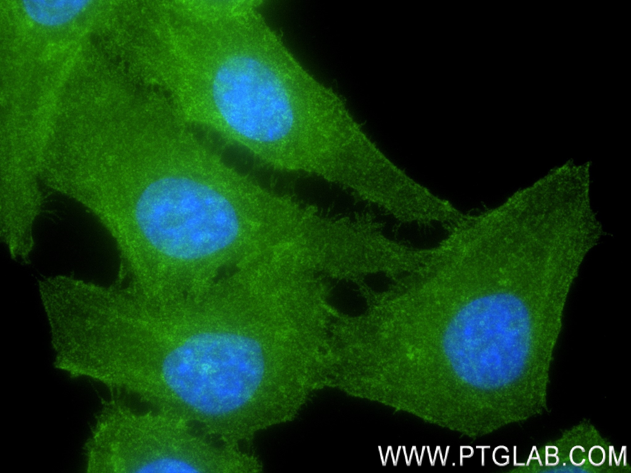 IF Staining of HepG2 using 83609-5-RR