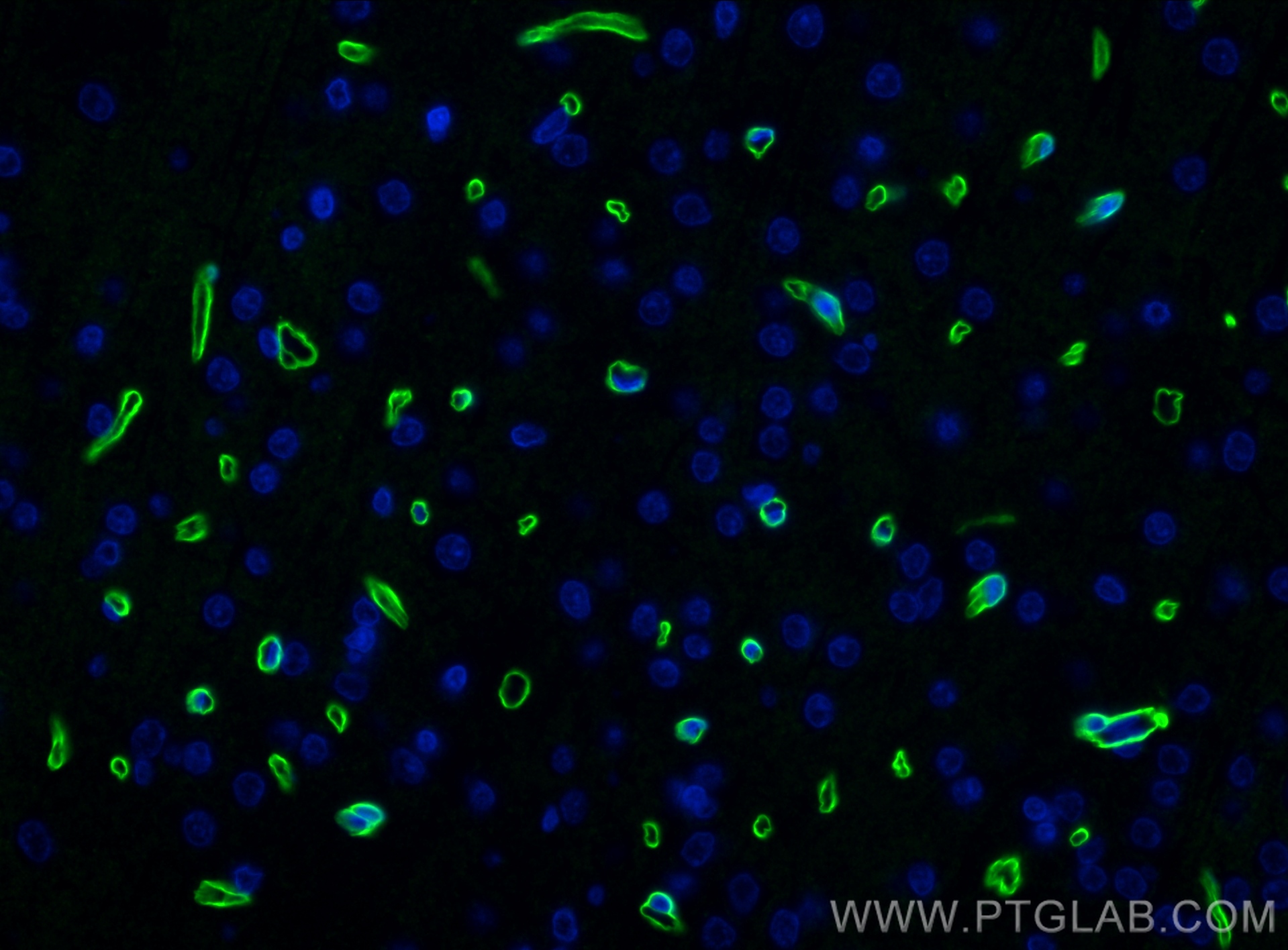 IF Staining of rat brain using 83609-5-RR