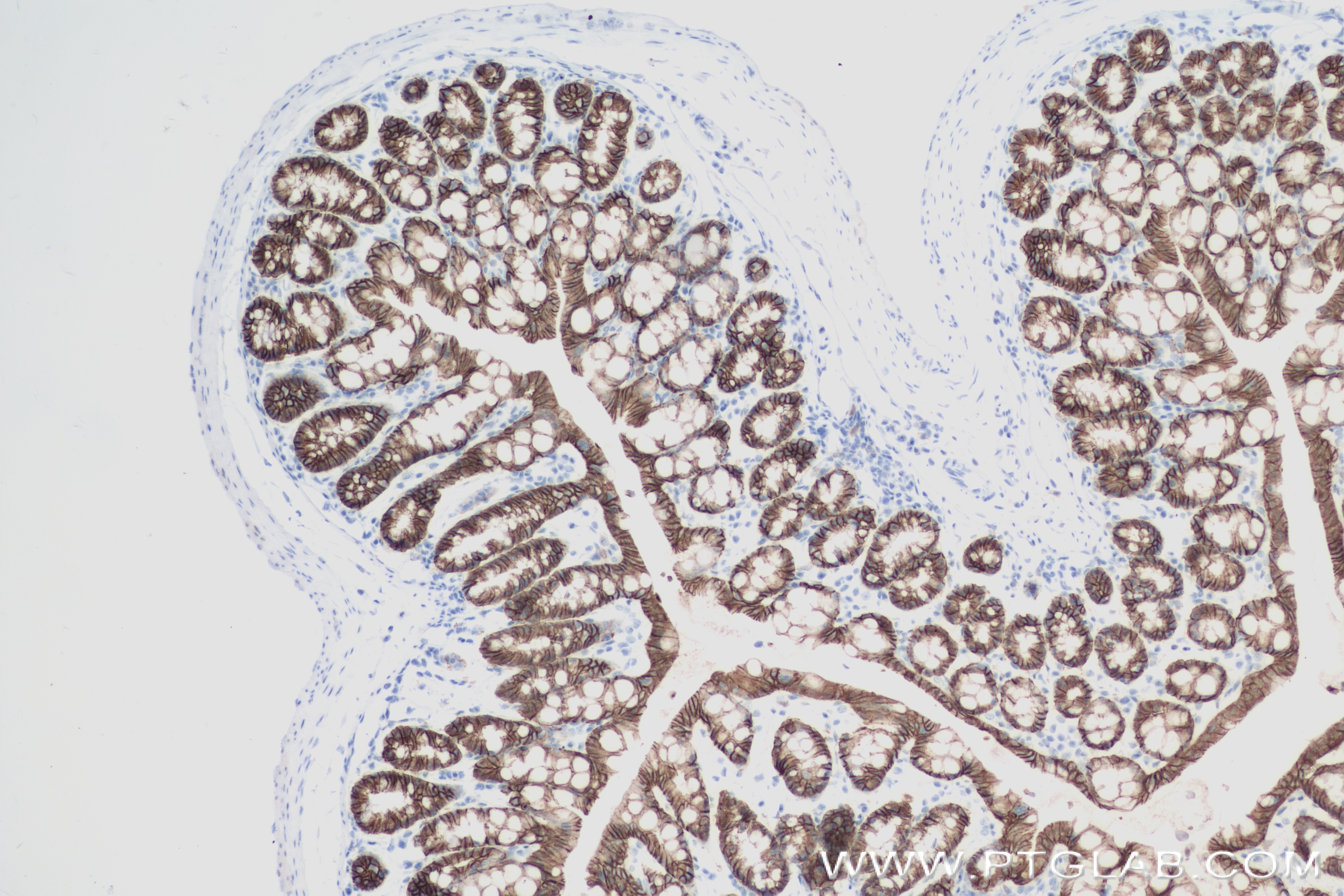 IHC staining of mouse colon using 84111-2-RR (same clone as 84111-2-PBS)