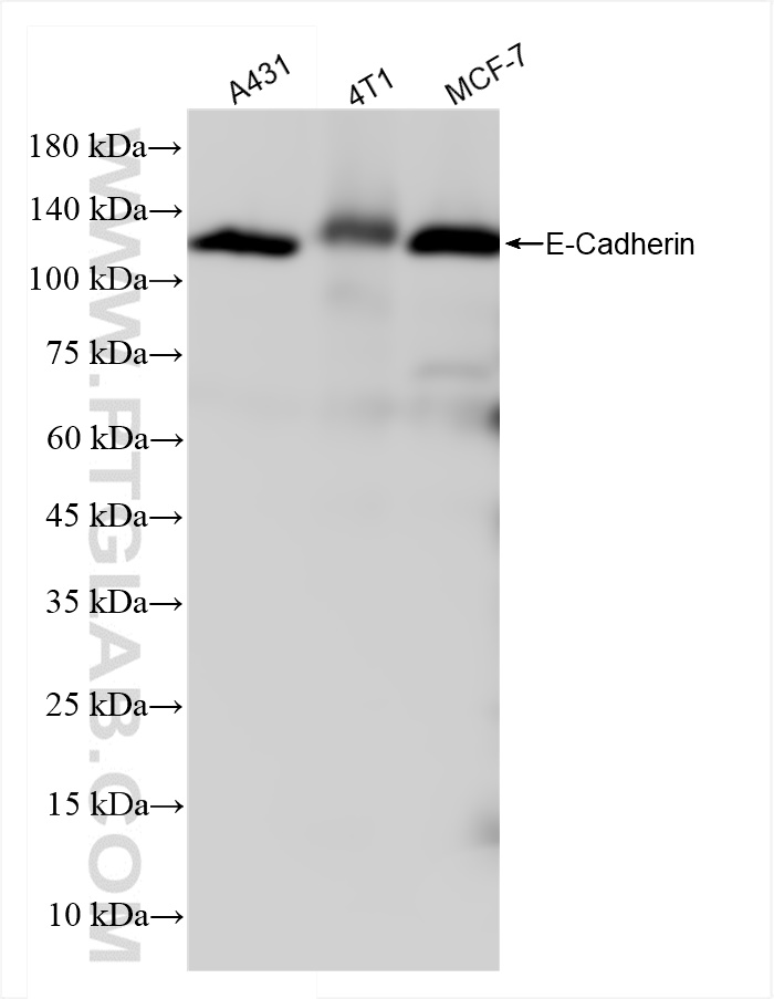 WB analysis using 84111-2-RR (same clone as 84111-2-PBS)