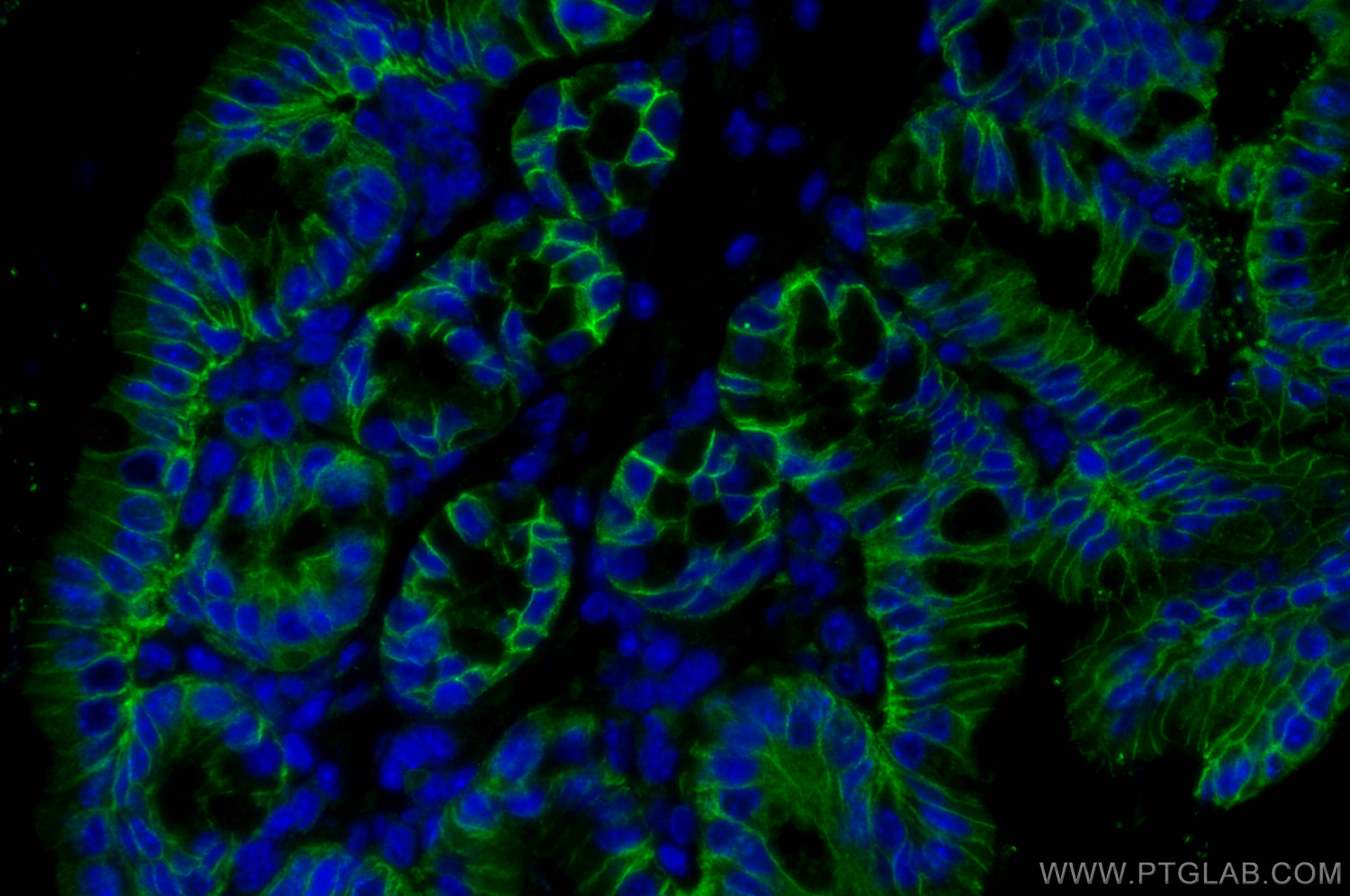 IF Staining of mouse colon using 20874-1-AP