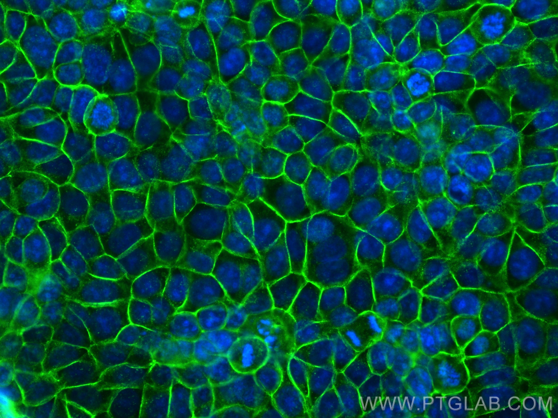 IF Staining of MCF-7 using 31515-1-AP