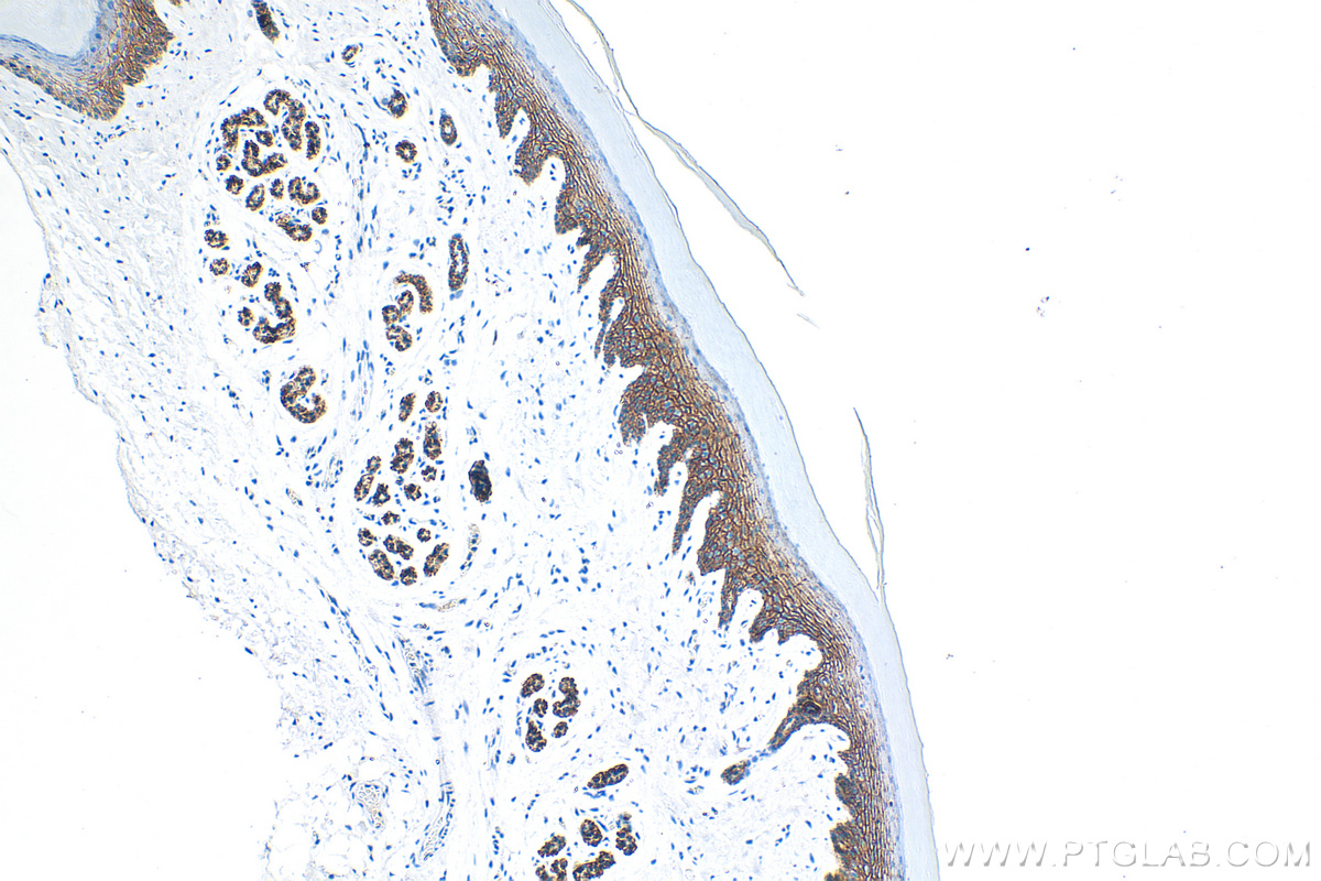 IHC staining of mouse skin using 31515-1-AP