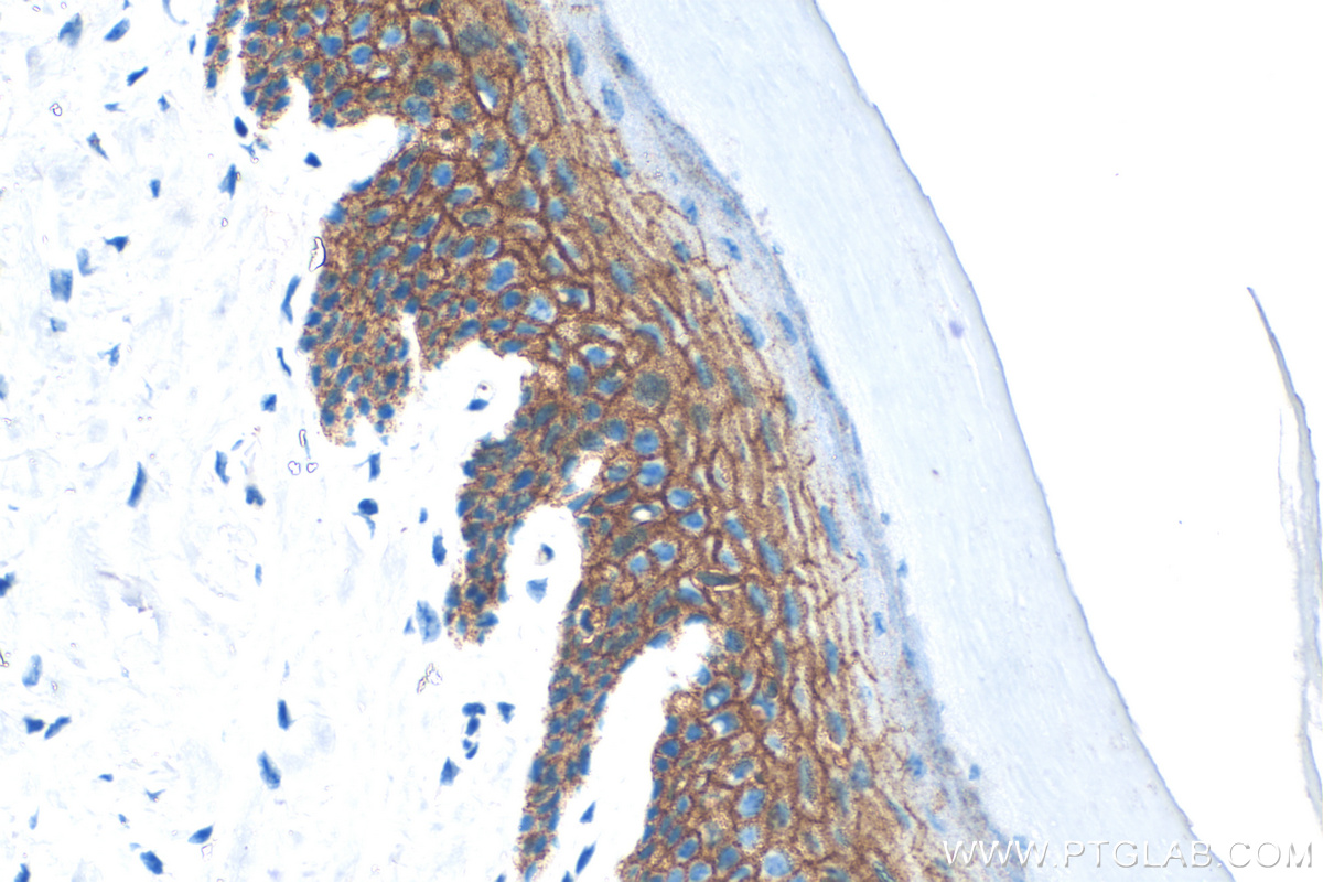 IHC staining of mouse skin using 31515-1-AP