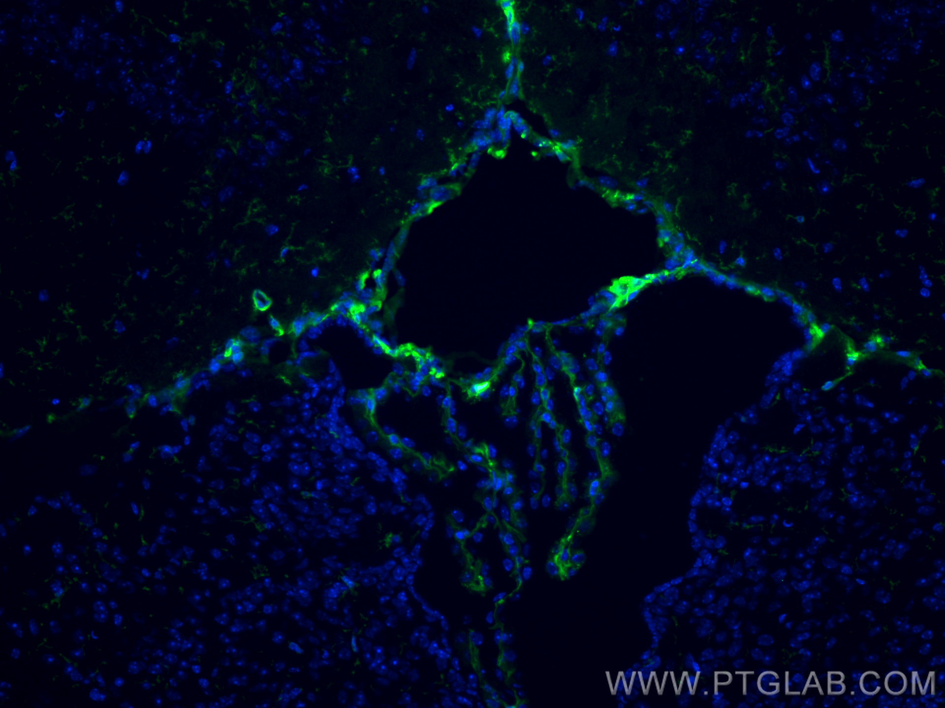 IF Staining of mouse brain using 60335-1-Ig