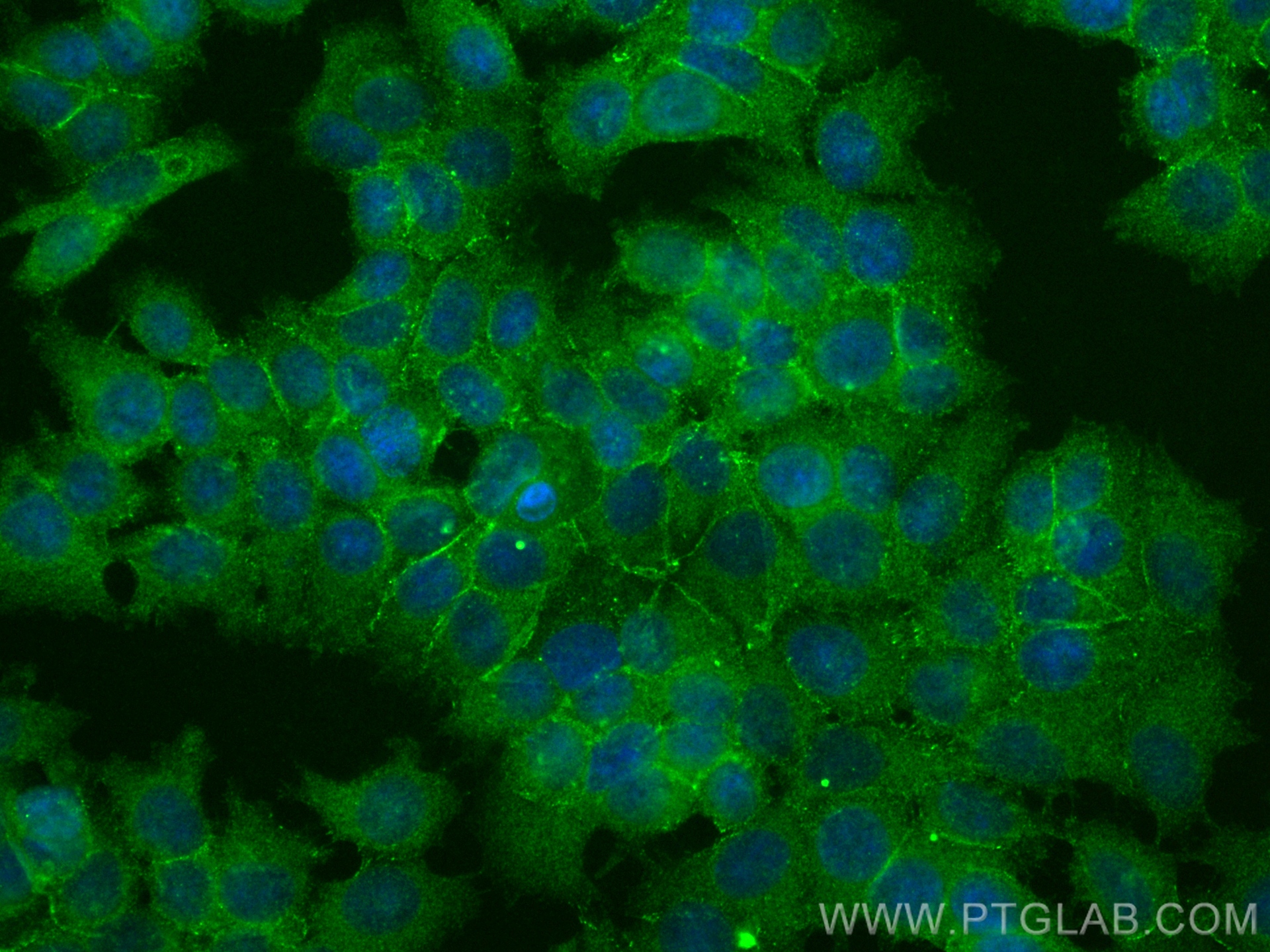 IF Staining of MCF-7 using 80541-5-RR