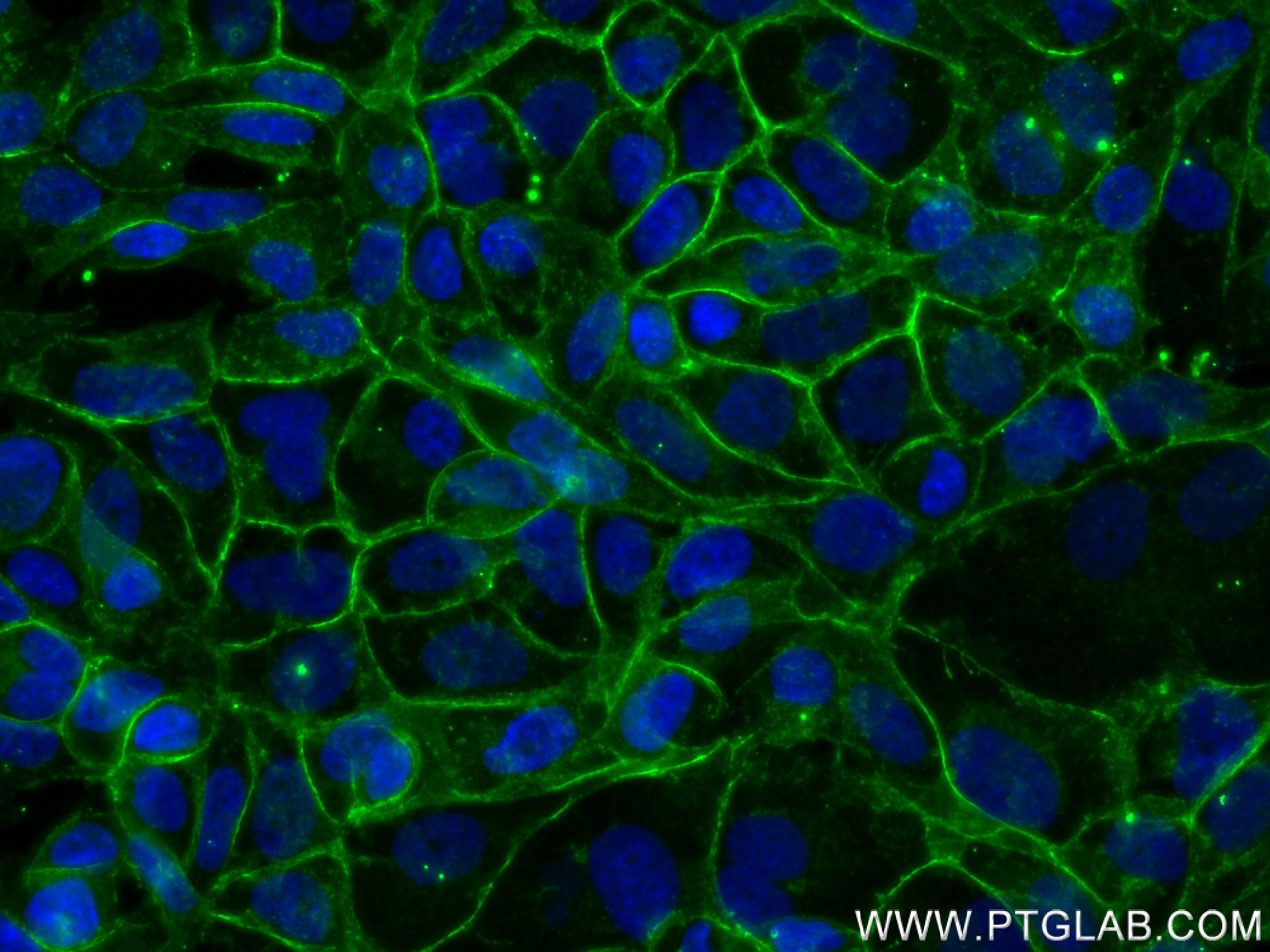 IF Staining of MCF-7 using 80541-7-RR (same clone as 80541-7-PBS)