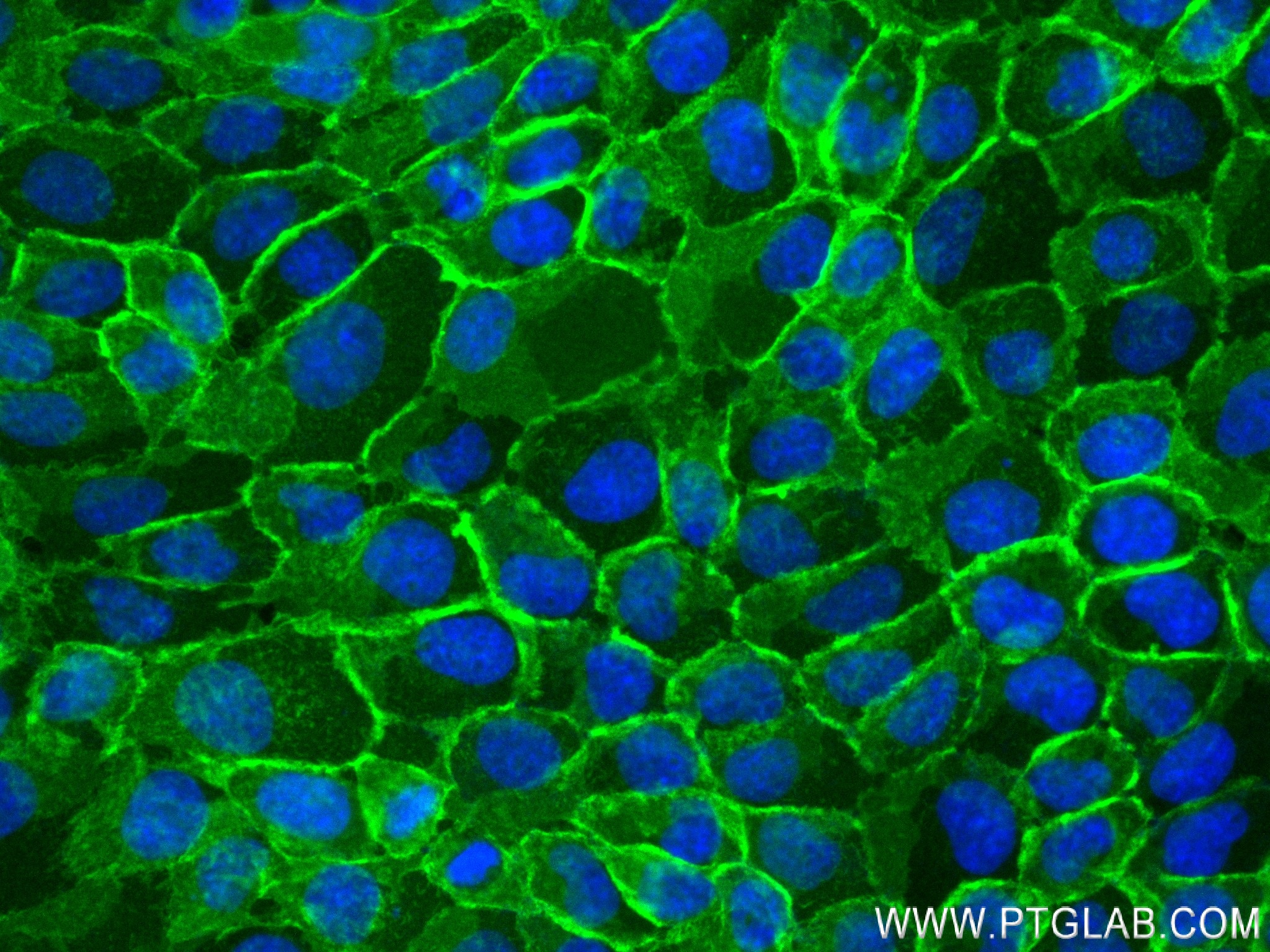 IF Staining of A431 using 83991-4-RR (same clone as 83991-4-PBS)