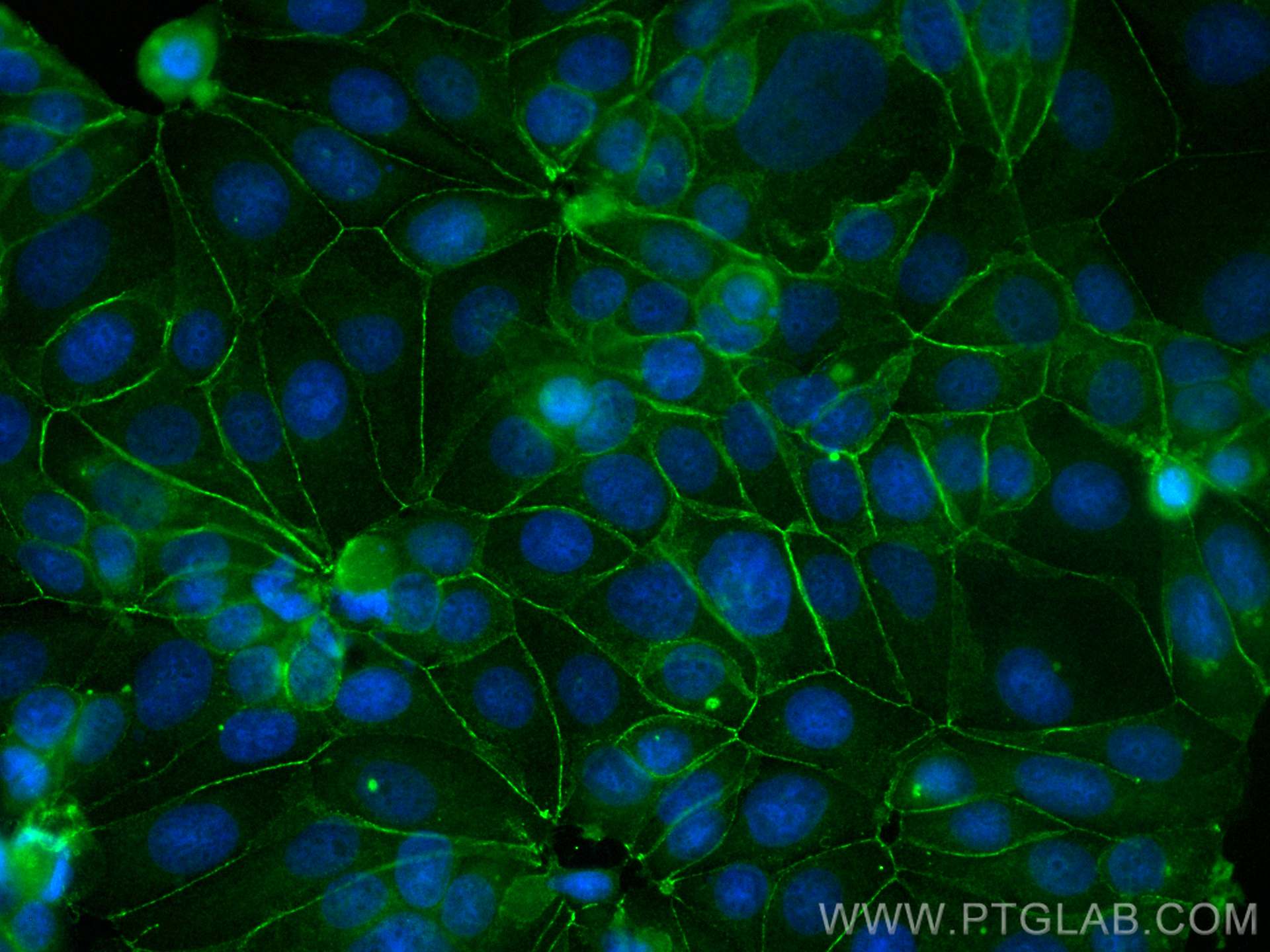 IF Staining of MCF-7 using CL488-60335