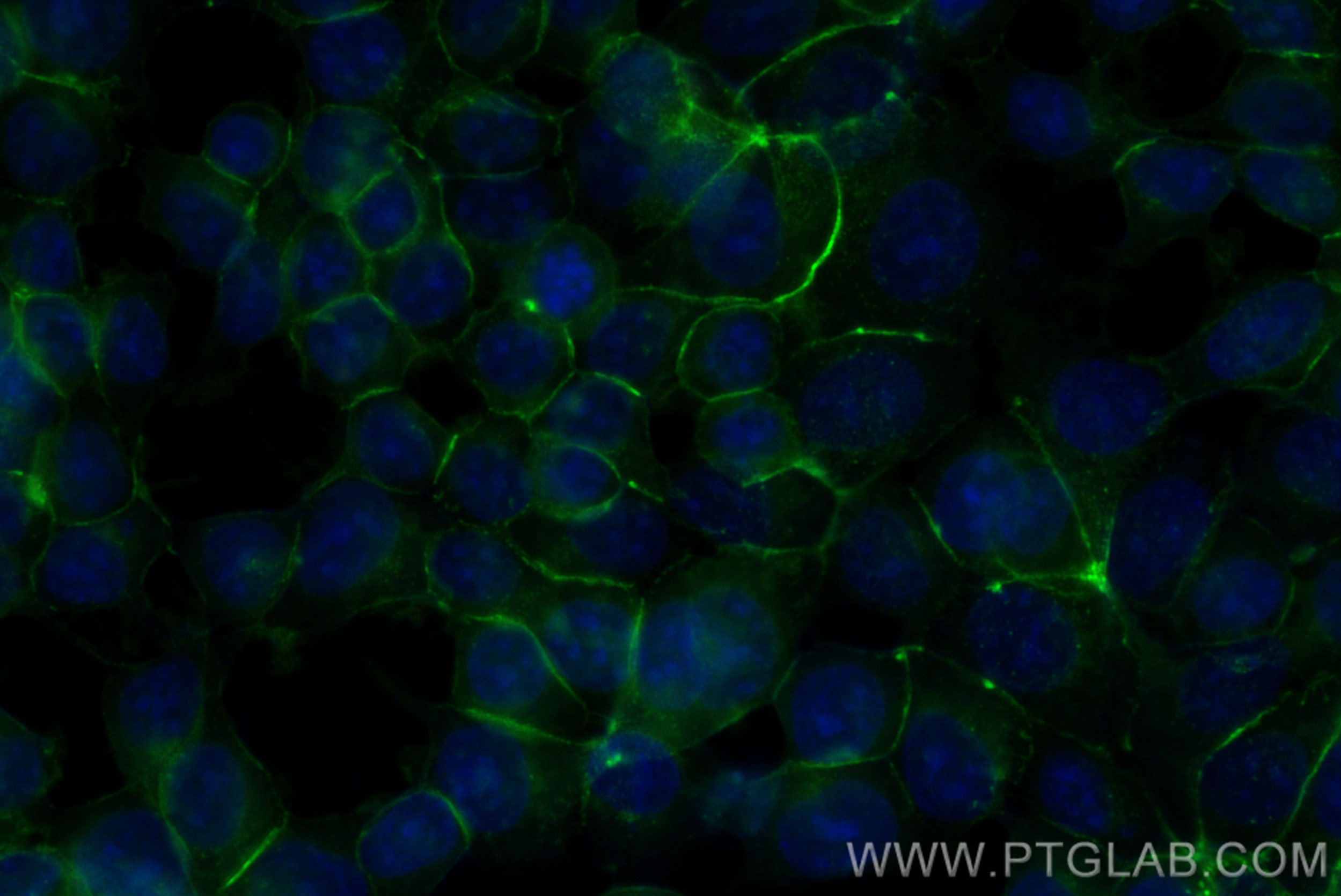 IF Staining of MCF-7 using CL488-80541-7