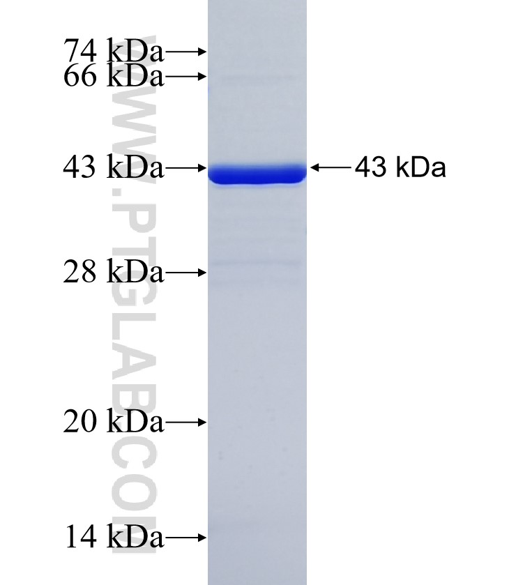 E2F2 fusion protein Ag35281 SDS-PAGE