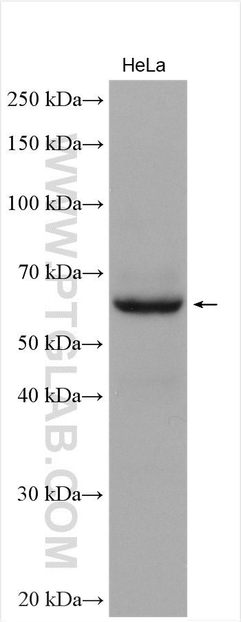 WB analysis using 21148-1-AP