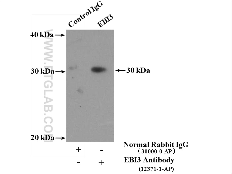 EBI3