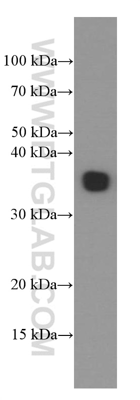 WB analysis of human spleen using 66354-1-Ig (same clone as 66354-1-PBS)