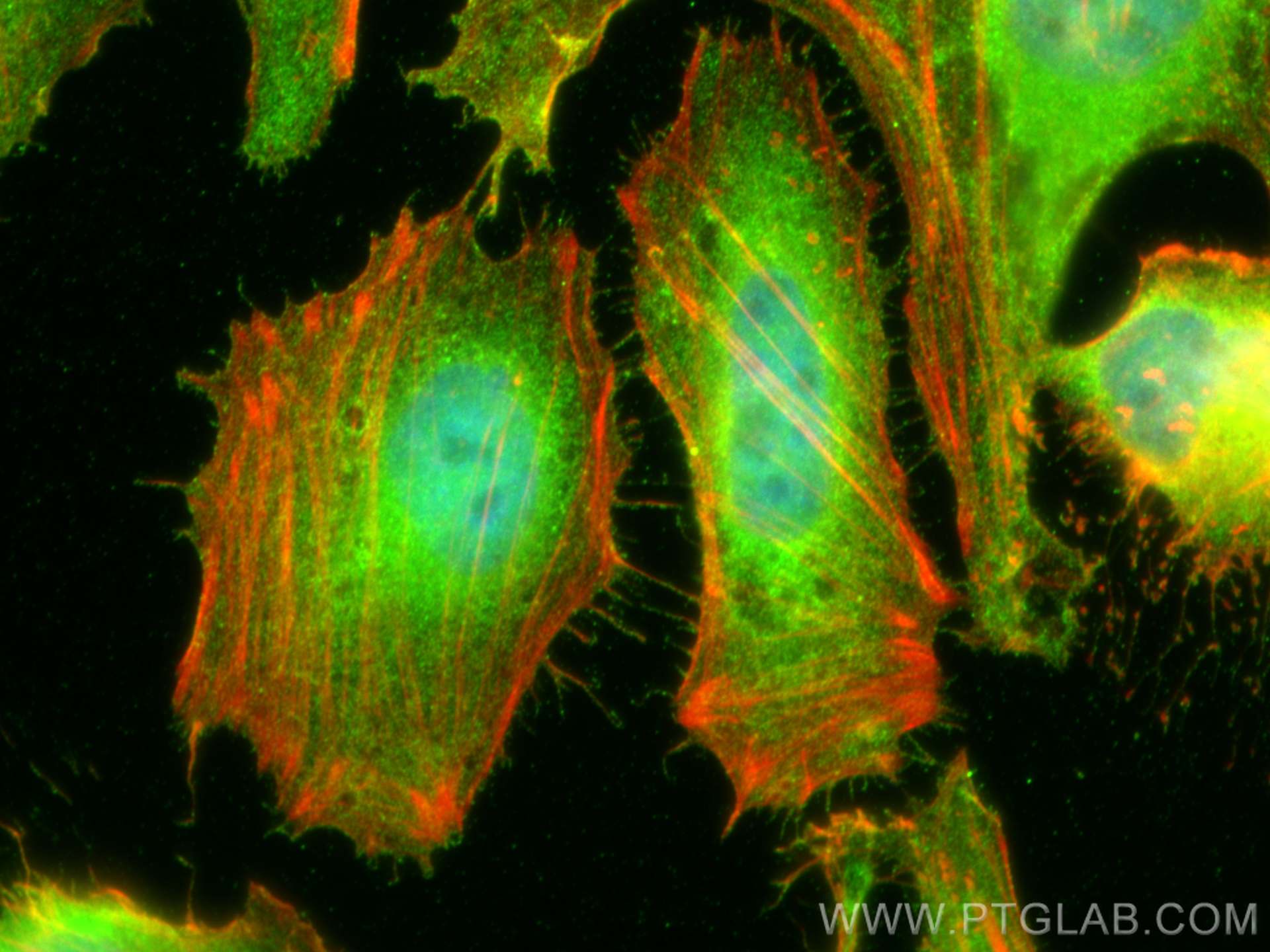 IF Staining of HeLa using 29771-1-AP