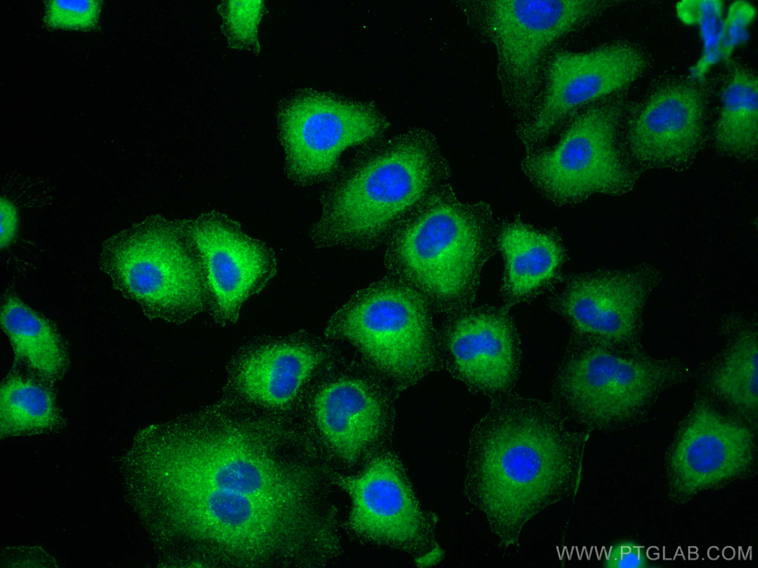 IF Staining of A549 using 29771-1-AP