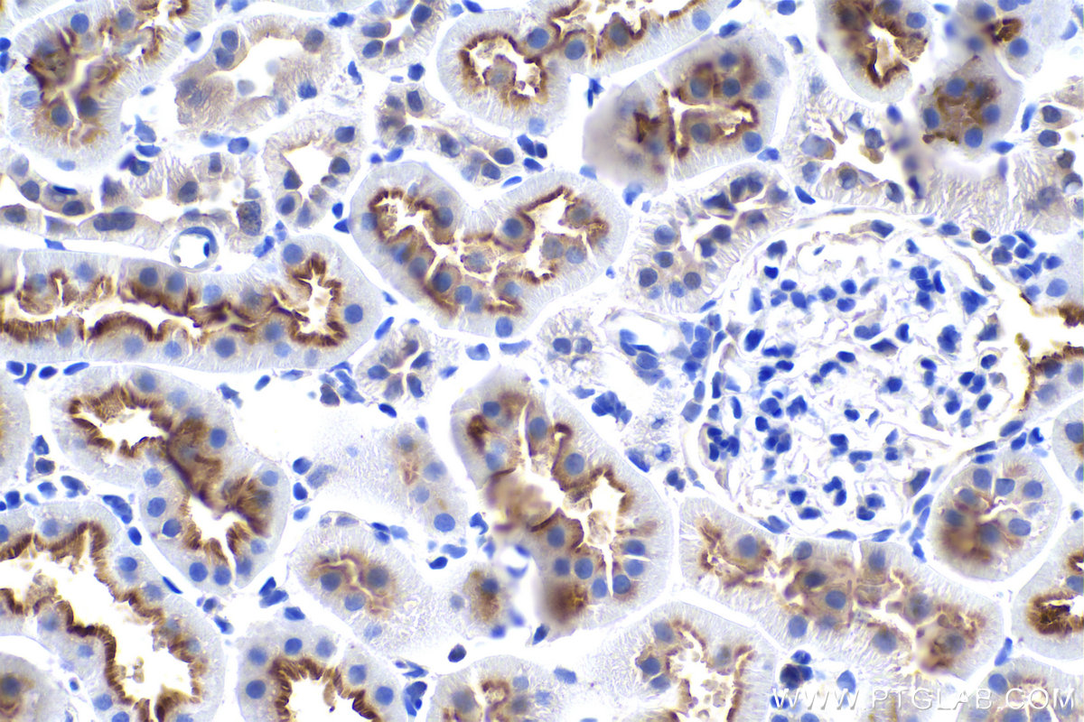 IHC staining of rat kidney using 29771-1-AP