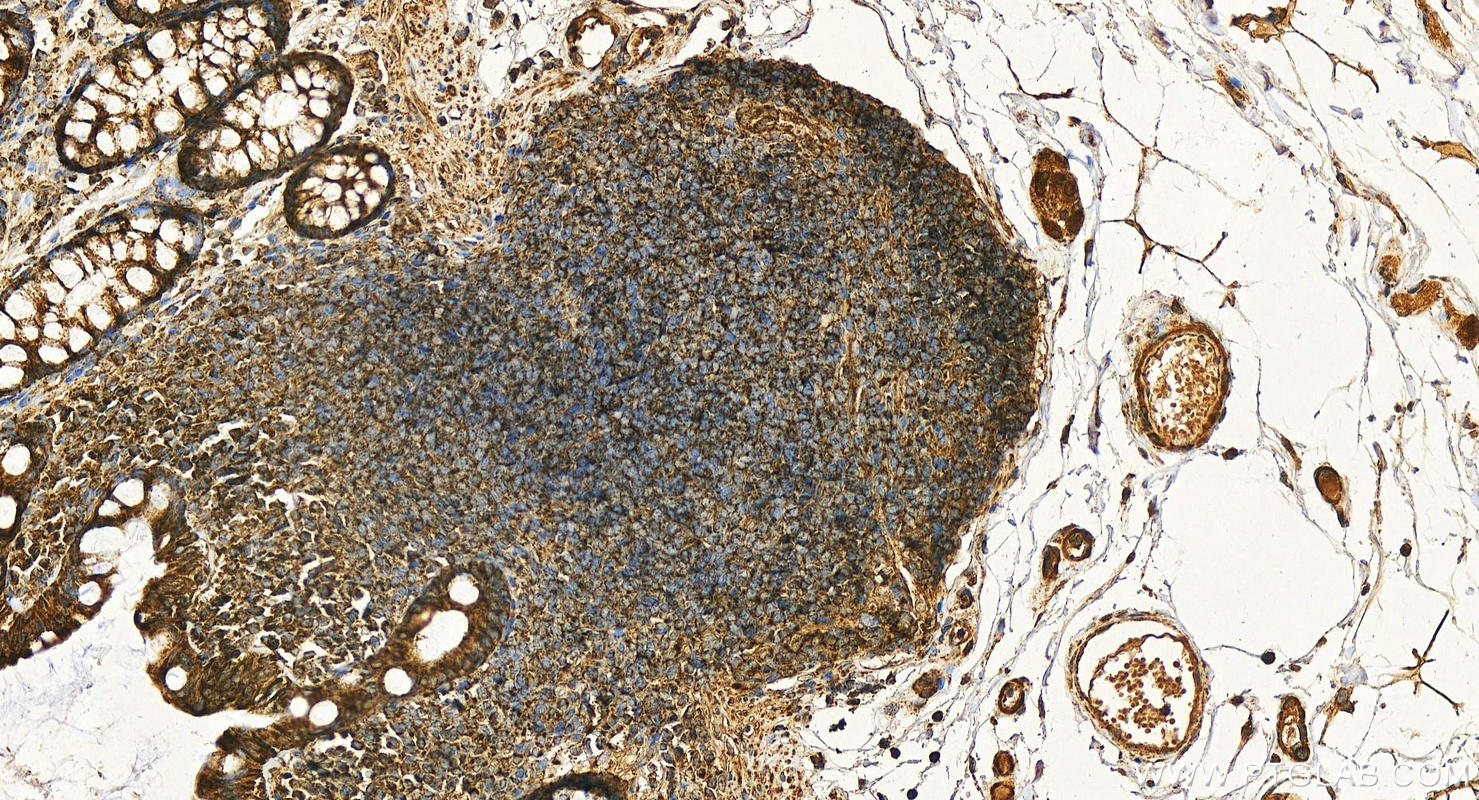 IHC staining of human colon using 11385-1-AP