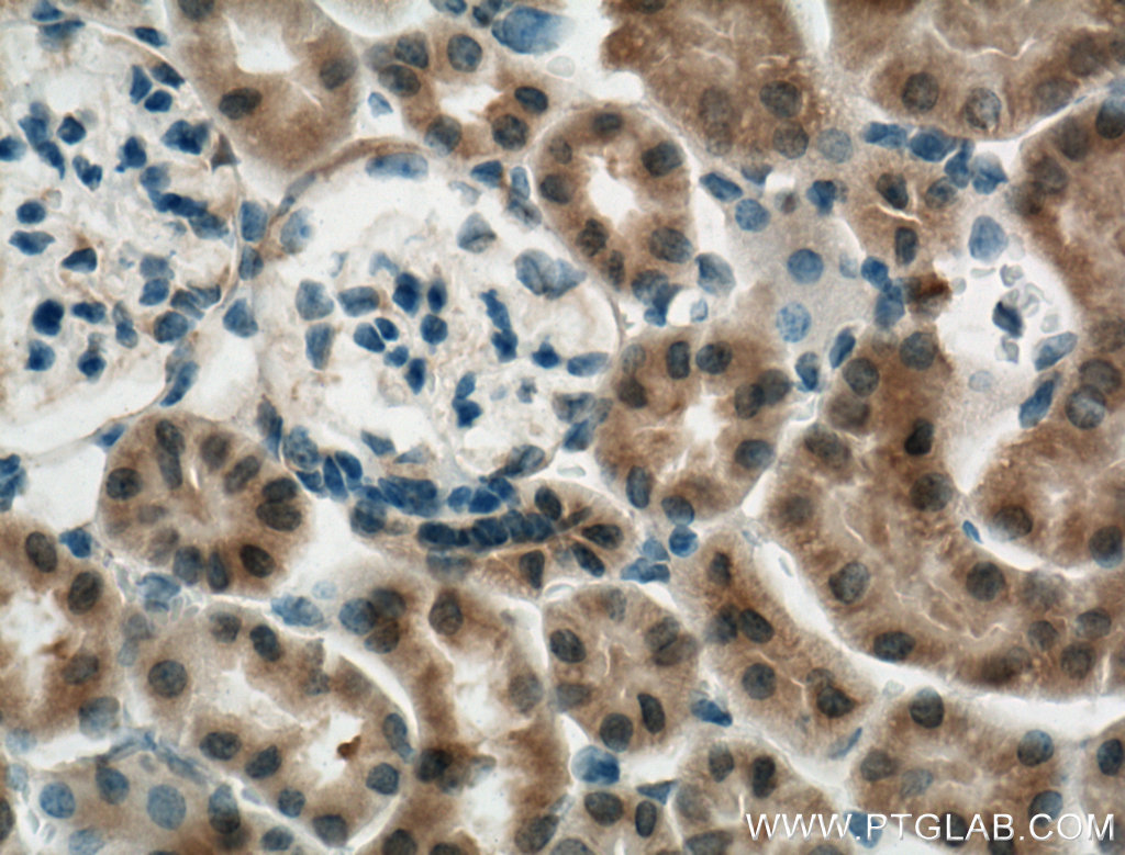 IHC staining of mouse kidney using 27732-1-AP