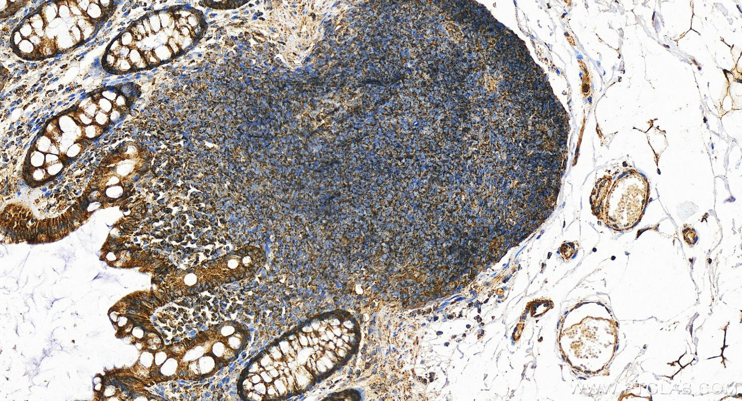 IHC staining of human colon using 11305-1-AP