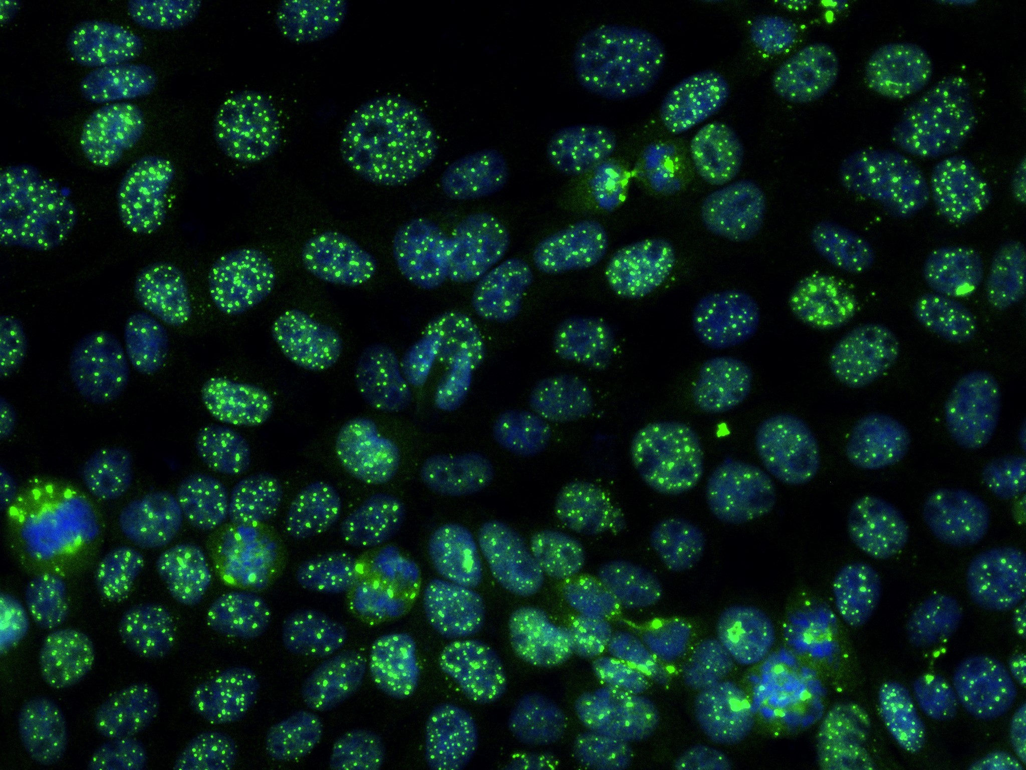 IF Staining of A431 using 83295-5-RR