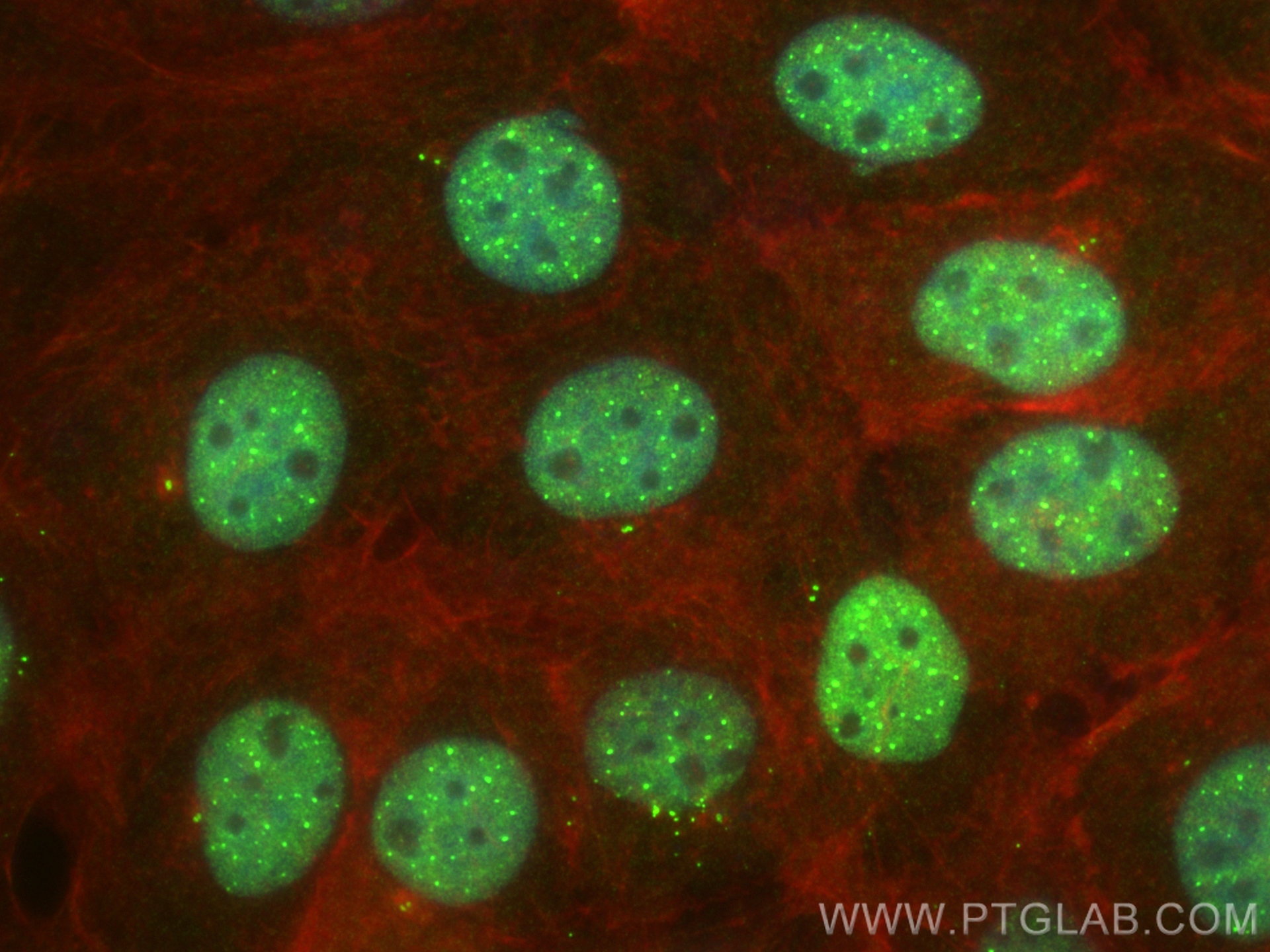 IF Staining of A431 using 83295-5-RR (same clone as 83295-5-PBS)