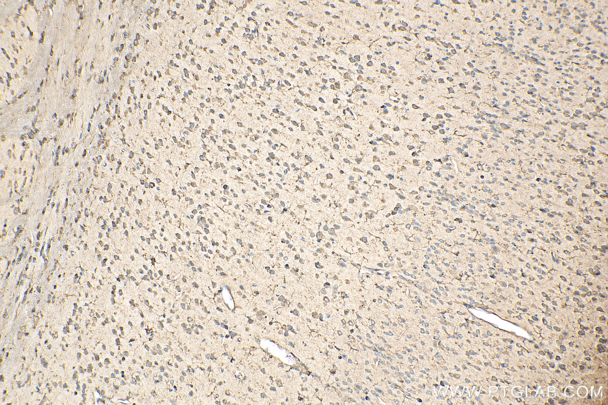 IHC staining of mouse brain using 81377-1-RR (same clone as 81377-1-PBS)