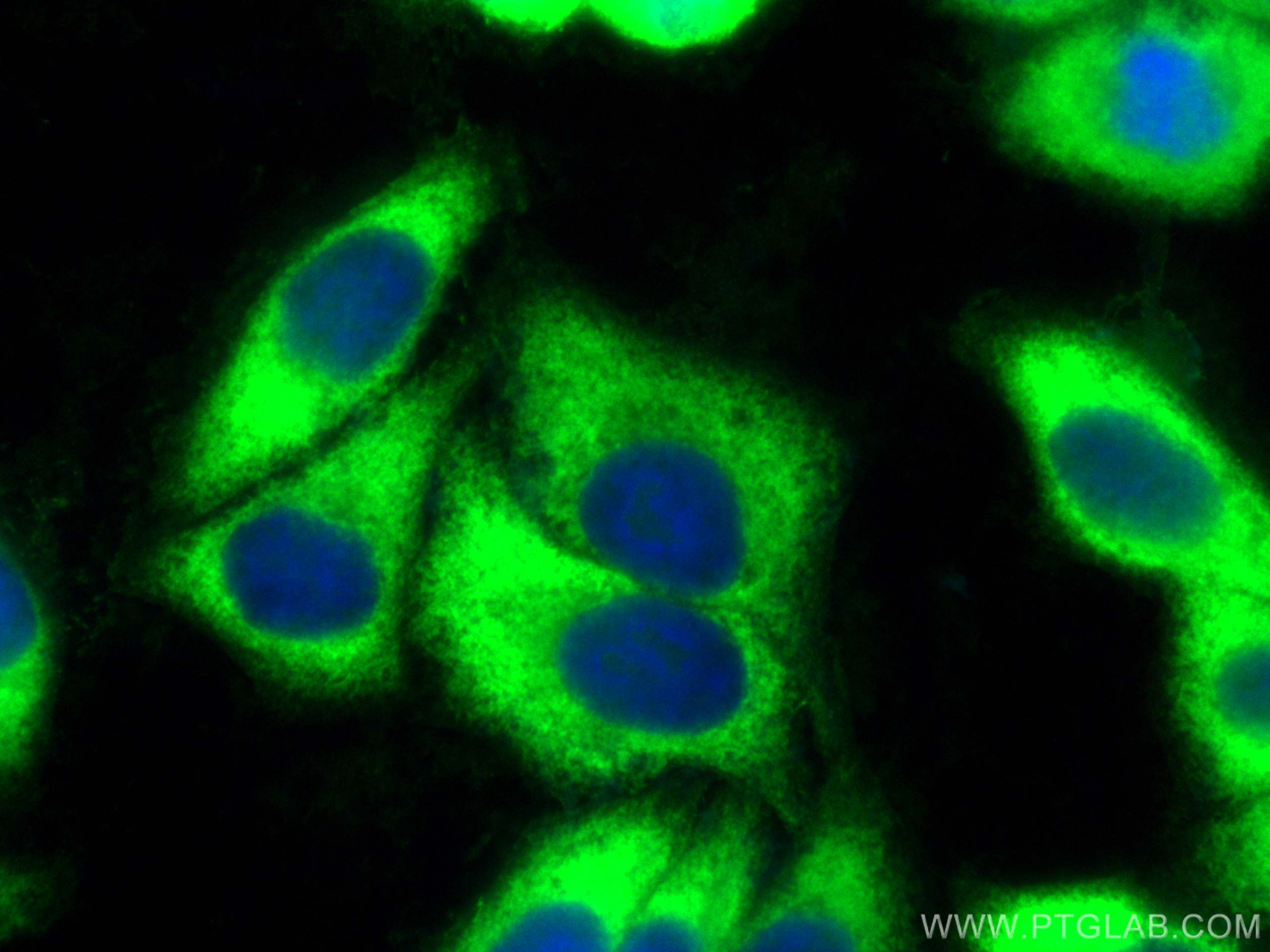IF Staining of HepG2 using CL488-11402