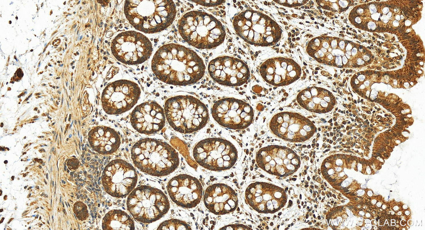 IHC staining of human  colon using 16091-1-AP