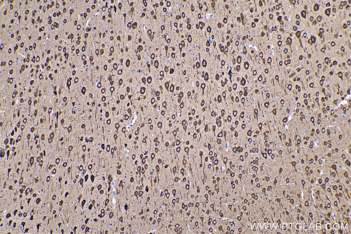 IHC staining of rat brain using 66806-1-Ig