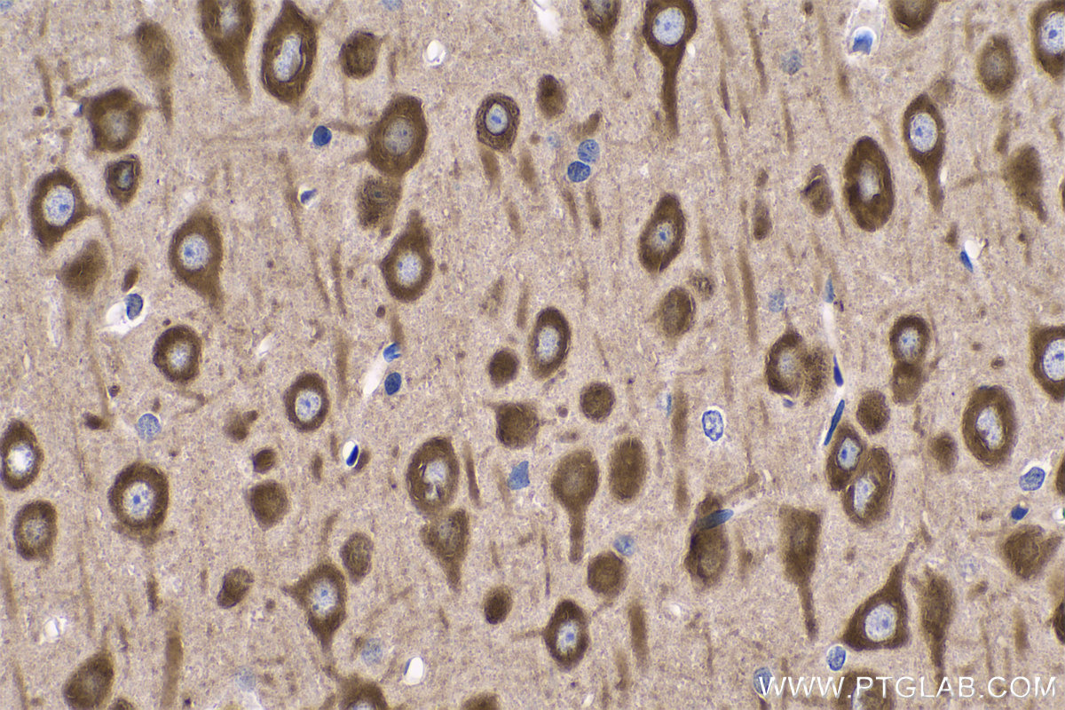 IHC staining of rat brain using 66806-1-Ig