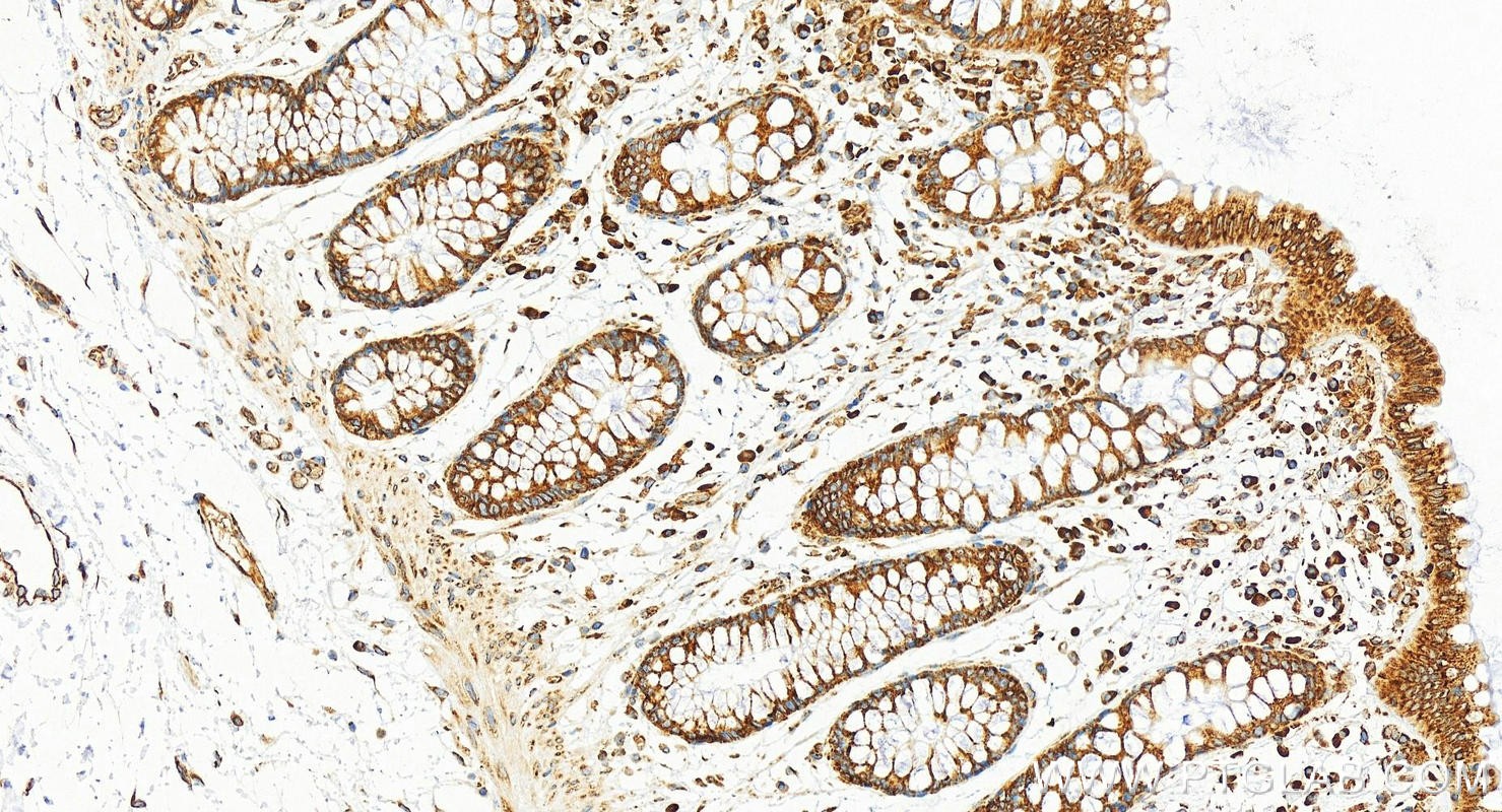 IHC staining of human colon using 60329-1-Ig