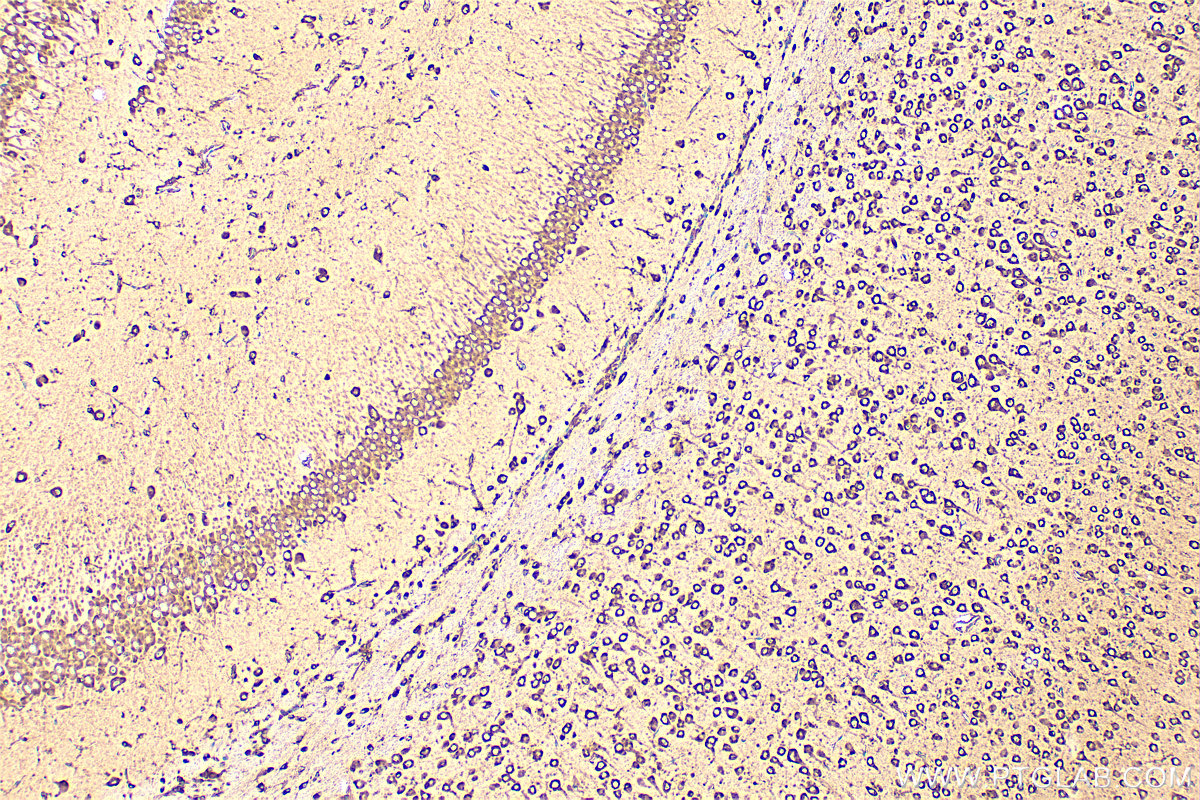 IHC staining of mouse brain using 10630-1-AP